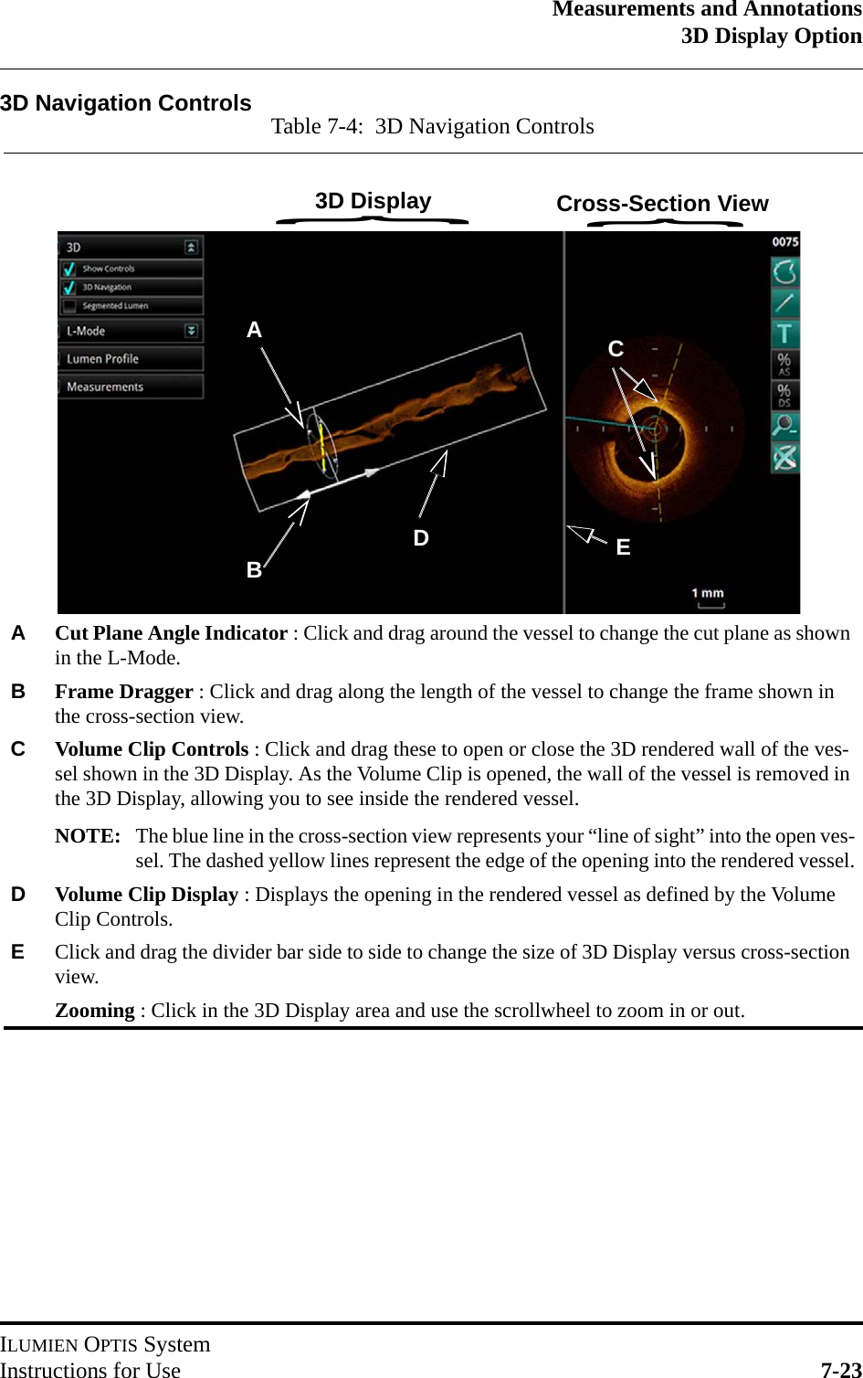 Measurements and Annotations3D Display OptionILUMIEN OPTIS SystemInstructions for Use 7-233D Navigation Controls Table 7-4:  3D Navigation ControlsACut Plane Angle Indicator : Click and drag around the vessel to change the cut plane as shown in the L-Mode.BFrame Dragger : Click and drag along the length of the vessel to change the frame shown in the cross-section view.CVolume Clip Controls : Click and drag these to open or close the 3D rendered wall of the ves-sel shown in the 3D Display. As the Volume Clip is opened, the wall of the vessel is removed in the 3D Display, allowing you to see inside the rendered vessel.NOTE: The blue line in the cross-section view represents your “line of sight” into the open ves-sel. The dashed yellow lines represent the edge of the opening into the rendered vessel.DVolume Clip Display : Displays the opening in the rendered vessel as defined by the Volume Clip Controls.EClick and drag the divider bar side to side to change the size of 3D Display versus cross-section view.Zooming : Click in the 3D Display area and use the scrollwheel to zoom in or out.ACBD{{3D Display Cross-Section ViewE