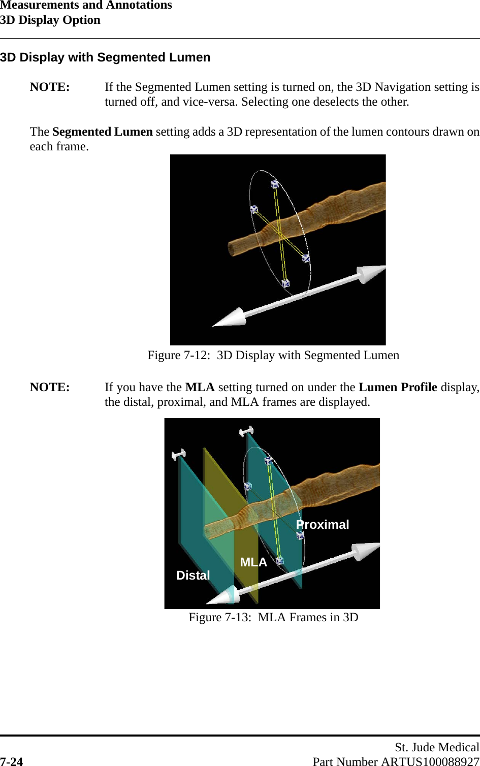 Measurements and Annotations3D Display OptionSt. Jude Medical7-24 Part Number ARTUS1000889273D Display with Segmented LumenNOTE: If the Segmented Lumen setting is turned on, the 3D Navigation setting isturned off, and vice-versa. Selecting one deselects the other.The Segmented Lumen setting adds a 3D representation of the lumen contours drawn oneach frame.NOTE: If you have the MLA setting turned on under the Lumen Profile display,the distal, proximal, and MLA frames are displayed.Figure 7-12:  3D Display with Segmented LumenFigure 7-13:  MLA Frames in 3DDistalProximalMLA