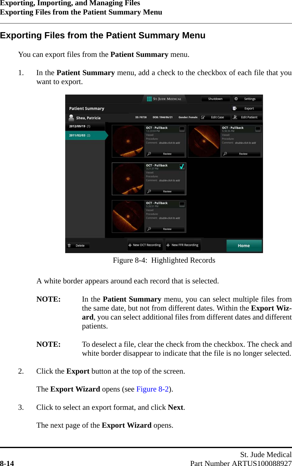 Exporting, Importing, and Managing FilesExporting Files from the Patient Summary MenuSt. Jude Medical8-14 Part Number ARTUS100088927Exporting Files from the Patient Summary Menu You can export files from the Patient Summary menu.1. In the Patient Summary menu, add a check to the checkbox of each file that youwant to export.A white border appears around each record that is selected.NOTE: In the Patient Summary menu, you can select multiple files fromthe same date, but not from different dates. Within the Export Wiz-ard, you can select additional files from different dates and differentpatients.NOTE: To deselect a file, clear the check from the checkbox. The check andwhite border disappear to indicate that the file is no longer selected.2. Click the Export button at the top of the screen.The Export Wizard opens (see Figure 8-2).3. Click to select an export format, and click Next.The next page of the Export Wizard opens. Figure 8-4:  Highlighted Records