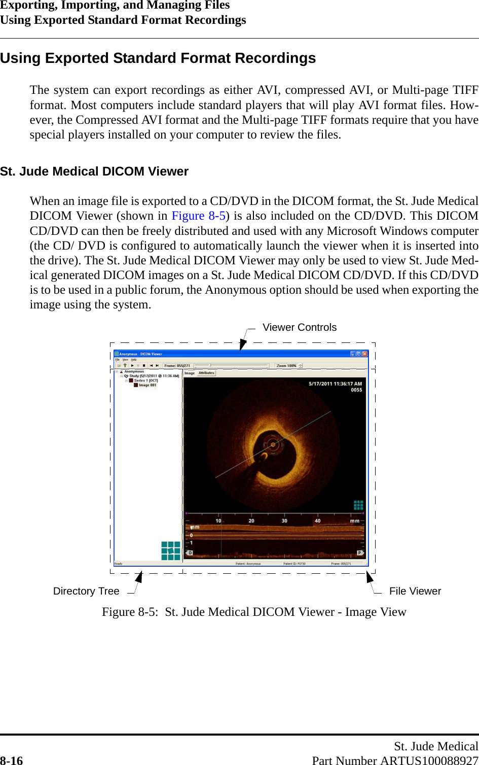 Exporting, Importing, and Managing FilesUsing Exported Standard Format RecordingsSt. Jude Medical8-16 Part Number ARTUS100088927Using Exported Standard Format RecordingsThe system can export recordings as either AVI, compressed AVI, or Multi-page TIFFformat. Most computers include standard players that will play AVI format files. How-ever, the Compressed AVI format and the Multi-page TIFF formats require that you havespecial players installed on your computer to review the files.St. Jude Medical DICOM ViewerWhen an image file is exported to a CD/DVD in the DICOM format, the St. Jude MedicalDICOM Viewer (shown in Figure 8-5) is also included on the CD/DVD. This DICOMCD/DVD can then be freely distributed and used with any Microsoft Windows computer(the CD/ DVD is configured to automatically launch the viewer when it is inserted intothe drive). The St. Jude Medical DICOM Viewer may only be used to view St. Jude Med-ical generated DICOM images on a St. Jude Medical DICOM CD/DVD. If this CD/DVDis to be used in a public forum, the Anonymous option should be used when exporting theimage using the system.Figure 8-5:  St. Jude Medical DICOM Viewer - Image ViewViewer ControlsDirectory Tree File Viewer