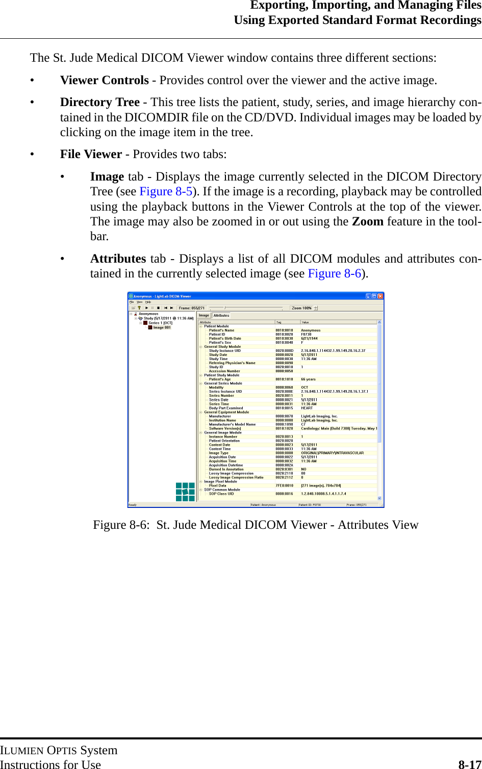 Exporting, Importing, and Managing FilesUsing Exported Standard Format RecordingsILUMIEN OPTIS SystemInstructions for Use 8-17The St. Jude Medical DICOM Viewer window contains three different sections:•Viewer Controls - Provides control over the viewer and the active image.•Directory Tree - This tree lists the patient, study, series, and image hierarchy con-tained in the DICOMDIR file on the CD/DVD. Individual images may be loaded byclicking on the image item in the tree.•File Viewer - Provides two tabs:•Image tab - Displays the image currently selected in the DICOM DirectoryTree (see Figure 8-5). If the image is a recording, playback may be controlledusing the playback buttons in the Viewer Controls at the top of the viewer.The image may also be zoomed in or out using the Zoom feature in the tool-bar.•Attributes tab - Displays a list of all DICOM modules and attributes con-tained in the currently selected image (see Figure 8-6).Figure 8-6:  St. Jude Medical DICOM Viewer - Attributes View