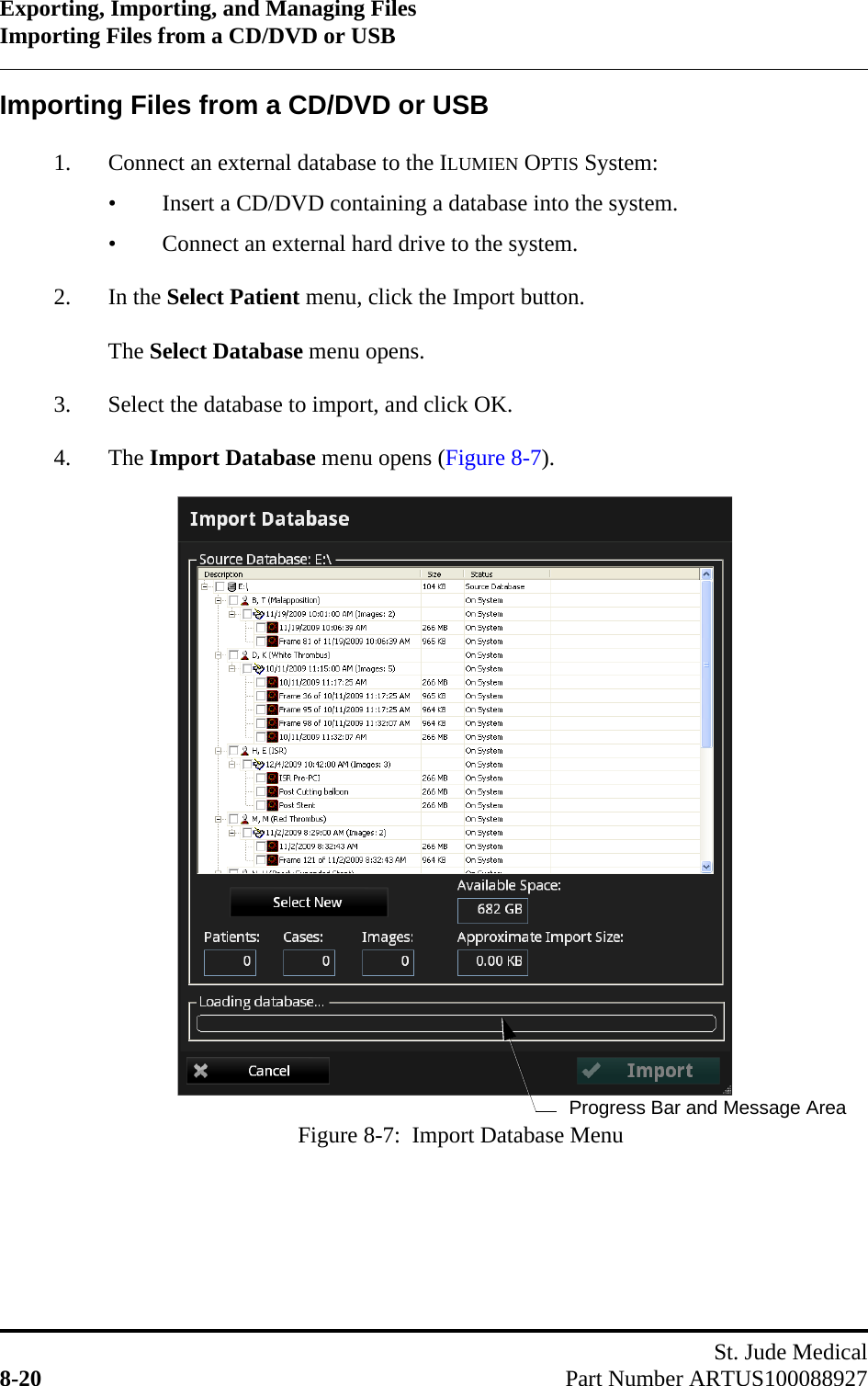 Exporting, Importing, and Managing FilesImporting Files from a CD/DVD or USBSt. Jude Medical8-20 Part Number ARTUS100088927Importing Files from a CD/DVD or USB1. Connect an external database to the ILUMIEN OPTIS System:• Insert a CD/DVD containing a database into the system.• Connect an external hard drive to the system.2. In the Select Patient menu, click the Import button.The Select Database menu opens.3. Select the database to import, and click OK.4. The Import Database menu opens (Figure 8-7).Figure 8-7:  Import Database MenuProgress Bar and Message Area