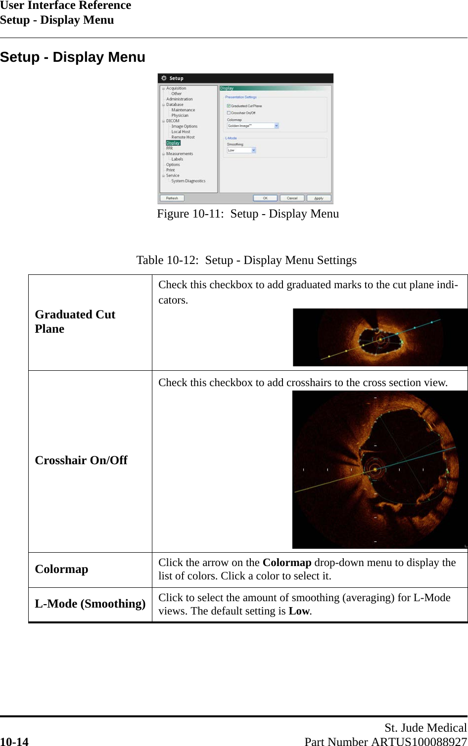 User Interface ReferenceSetup - Display MenuSt. Jude Medical10-14 Part Number ARTUS100088927Setup - Display MenuTable 10-12:  Setup - Display Menu SettingsGraduated Cut PlaneCheck this checkbox to add graduated marks to the cut plane indi-cators.Crosshair On/OffCheck this checkbox to add crosshairs to the cross section view. Colormap Click the arrow on the Colormap drop-down menu to display the list of colors. Click a color to select it.L-Mode (Smoothing) Click to select the amount of smoothing (averaging) for L-Mode views. The default setting is Low.Figure 10-11:  Setup - Display Menu