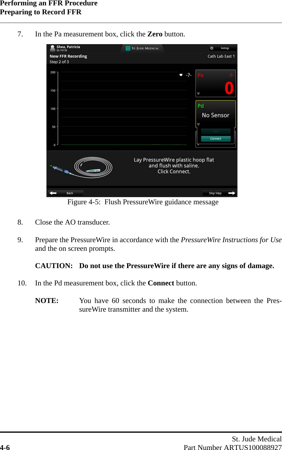 Performing an FFR ProcedurePreparing to Record FFRSt. Jude Medical4-6 Part Number ARTUS1000889277. In the Pa measurement box, click the Zero button. 8. Close the AO transducer.9. Prepare the PressureWire in accordance with the PressureWire Instructions for Useand the on screen prompts.CAUTION: Do not use the PressureWire if there are any signs of damage.10. In the Pd measurement box, click the Connect button.NOTE: You have 60 seconds to make the connection between the Pres-sureWire transmitter and the system.Figure 4-5:  Flush PressureWire guidance message