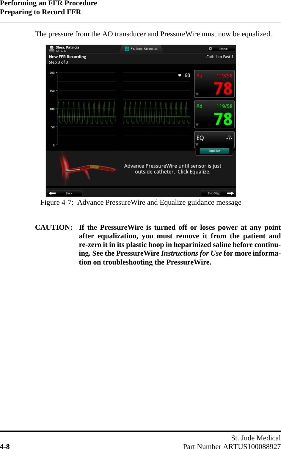 Performing an FFR ProcedurePreparing to Record FFRSt. Jude Medical4-8 Part Number ARTUS100088927The pressure from the AO transducer and PressureWire must now be equalized.CAUTION: If the PressureWire is turned off or loses power at any pointafter equalization, you must remove it from the patient andre-zero it in its plastic hoop in heparinized saline before continu-ing. See the PressureWire Instructions for Use for more informa-tion on troubleshooting the PressureWire.Figure 4-7:  Advance PressureWire and Equalize guidance message