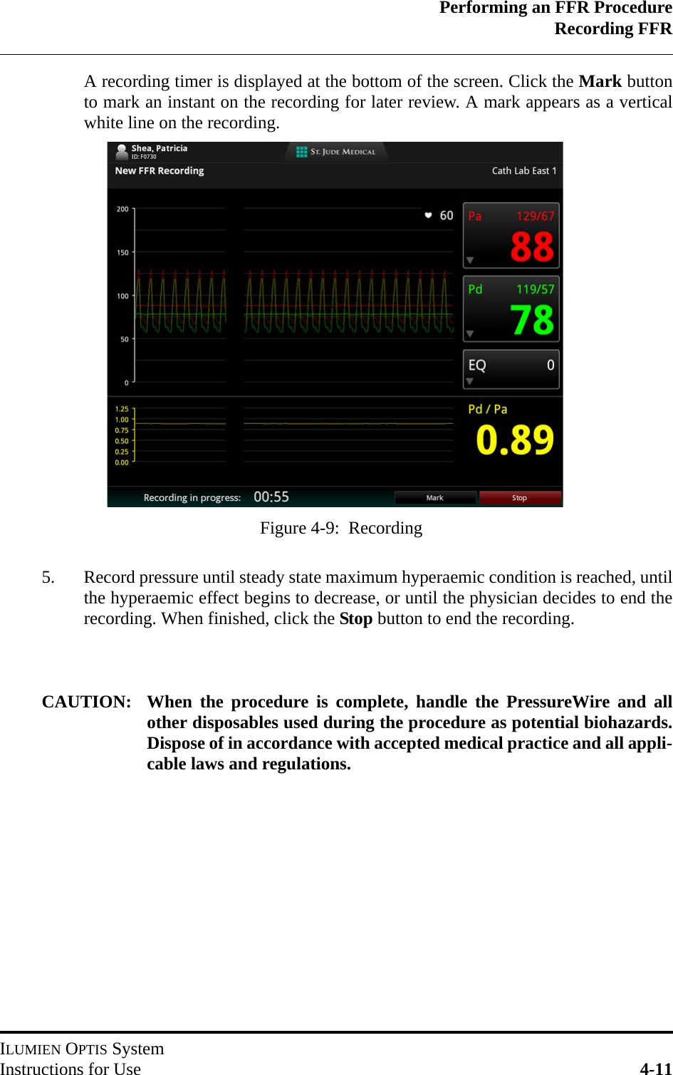 Performing an FFR ProcedureRecording FFRILUMIEN OPTIS SystemInstructions for Use 4-11A recording timer is displayed at the bottom of the screen. Click the Mark buttonto mark an instant on the recording for later review. A mark appears as a verticalwhite line on the recording.5. Record pressure until steady state maximum hyperaemic condition is reached, untilthe hyperaemic effect begins to decrease, or until the physician decides to end therecording. When finished, click the Stop button to end the recording.CAUTION: When the procedure is complete, handle the PressureWire and allother disposables used during the procedure as potential biohazards.Dispose of in accordance with accepted medical practice and all appli-cable laws and regulations.Figure 4-9:  Recording