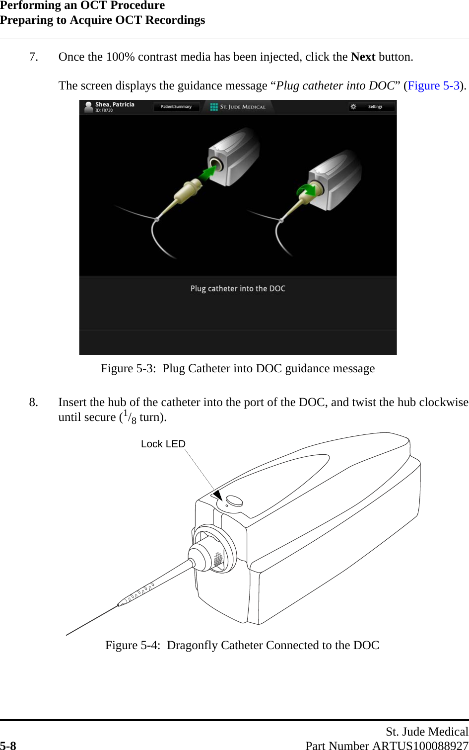 Performing an OCT ProcedurePreparing to Acquire OCT RecordingsSt. Jude Medical5-8 Part Number ARTUS1000889277. Once the 100% contrast media has been injected, click the Next button.The screen displays the guidance message “Plug catheter into DOC” (Figure 5-3).8. Insert the hub of the catheter into the port of the DOC, and twist the hub clockwiseuntil secure (1/8 turn).Figure 5-3:  Plug Catheter into DOC guidance messageFigure 5-4:  Dragonfly Catheter Connected to the DOCLock LED