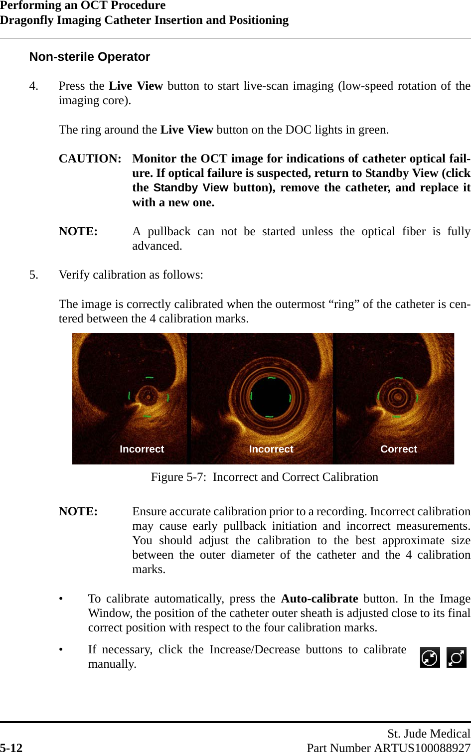 Performing an OCT ProcedureDragonfly Imaging Catheter Insertion and PositioningSt. Jude Medical5-12 Part Number ARTUS100088927Non-sterile Operator4. Press the Live View button to start live-scan imaging (low-speed rotation of theimaging core).The ring around the Live View button on the DOC lights in green.CAUTION: Monitor the OCT image for indications of catheter optical fail-ure. If optical failure is suspected, return to Standby View (clickthe Standby View button), remove the catheter, and replace itwith a new one.NOTE: A pullback can not be started unless the optical fiber is fullyadvanced.5. Verify calibration as follows:The image is correctly calibrated when the outermost “ring” of the catheter is cen-tered between the 4 calibration marks. NOTE: Ensure accurate calibration prior to a recording. Incorrect calibrationmay cause early pullback initiation and incorrect measurements.You should adjust the calibration to the best approximate sizebetween the outer diameter of the catheter and the 4 calibrationmarks. • To calibrate automatically, press the Auto-calibrate button. In the ImageWindow, the position of the catheter outer sheath is adjusted close to its finalcorrect position with respect to the four calibration marks.• If necessary, click the Increase/Decrease buttons to calibratemanually.Figure 5-7:  Incorrect and Correct CalibrationIncorrect Incorrect Correct