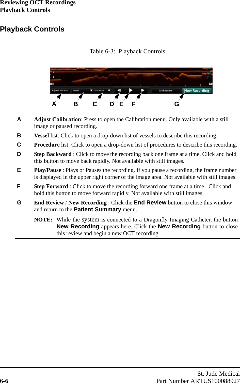 Reviewing OCT RecordingsPlayback ControlsSt. Jude Medical6-6 Part Number ARTUS100088927Playback ControlsTable 6-3:  Playback ControlsAAdjust Calibration: Press to open the Calibration menu. Only available with a still image or paused recording.BVessel list: Click to open a drop-down list of vessels to describe this recording.CProcedure list: Click to open a drop-down list of procedures to describe this recording.DStep Backward : Click to move the recording back one frame at a time. Click and hold this button to move back rapidly. Not available with still images.EPlay/Pause : Plays or Pauses the recording. If you pause a recording, the frame number is displayed in the upper right corner of the image area. Not available with still images.FStep Forward : Click to move the recording forward one frame at a time.  Click and hold this button to move forward rapidly. Not available with still images.GEnd Review / New Recording : Click the End Review button to close this window and return to the Patient Summary menu.NOTE: While the system is connected to a Dragonfly Imaging Catheter, the buttonNew Recording appears here. Click the New Recording button to closethis review and begin a new OCT recording.A E F GB C D