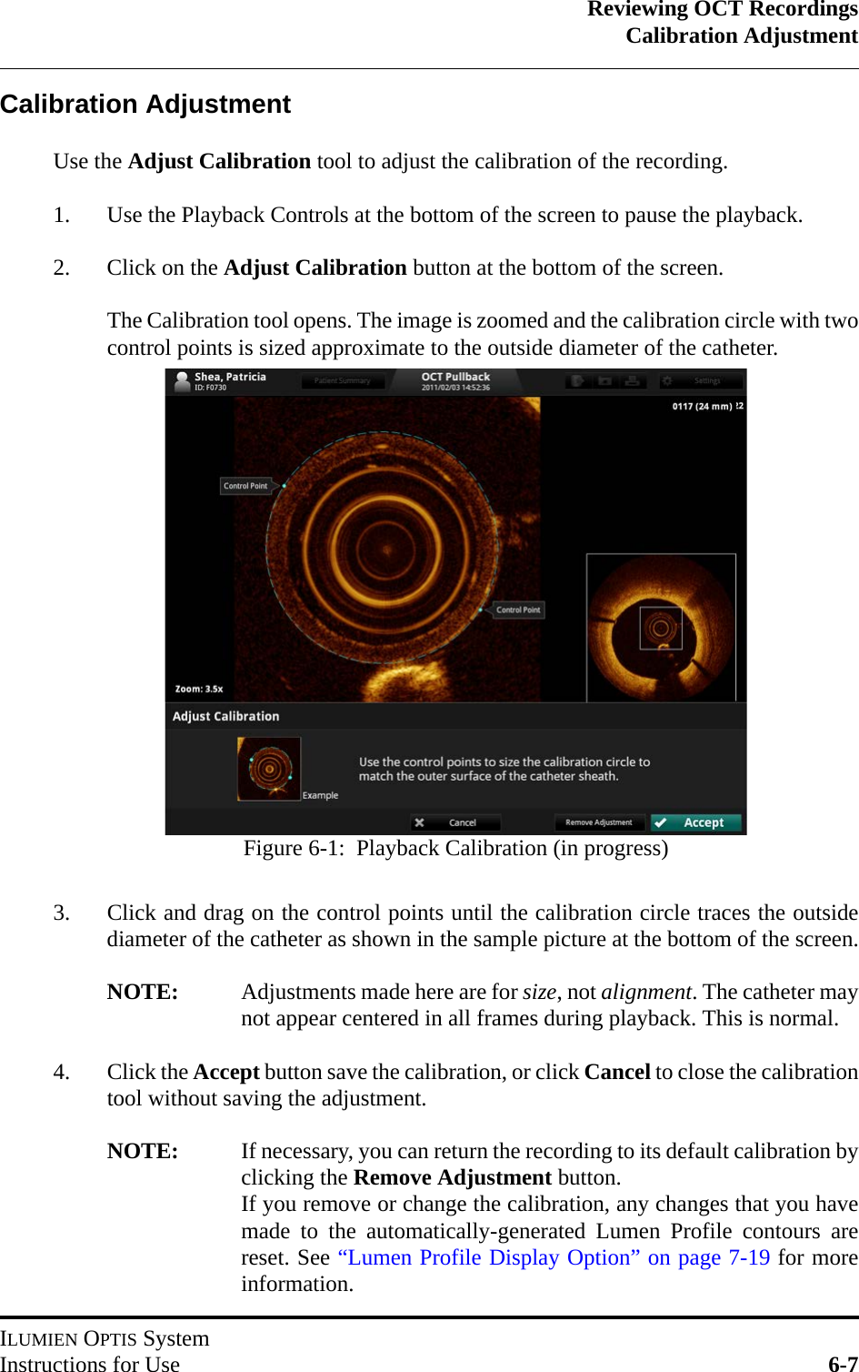 Reviewing OCT RecordingsCalibration AdjustmentILUMIEN OPTIS SystemInstructions for Use 6-7Calibration AdjustmentUse the Adjust Calibration tool to adjust the calibration of the recording.1. Use the Playback Controls at the bottom of the screen to pause the playback.2. Click on the Adjust Calibration button at the bottom of the screen.The Calibration tool opens. The image is zoomed and the calibration circle with twocontrol points is sized approximate to the outside diameter of the catheter.3. Click and drag on the control points until the calibration circle traces the outsidediameter of the catheter as shown in the sample picture at the bottom of the screen.NOTE: Adjustments made here are for size, not alignment. The catheter maynot appear centered in all frames during playback. This is normal.4. Click the Accept button save the calibration, or click Cancel to close the calibrationtool without saving the adjustment.NOTE: If necessary, you can return the recording to its default calibration byclicking the Remove Adjustment button.If you remove or change the calibration, any changes that you havemade to the automatically-generated Lumen Profile contours arereset. See “Lumen Profile Display Option” on page 7-19 for moreinformation.Figure 6-1:  Playback Calibration (in progress)