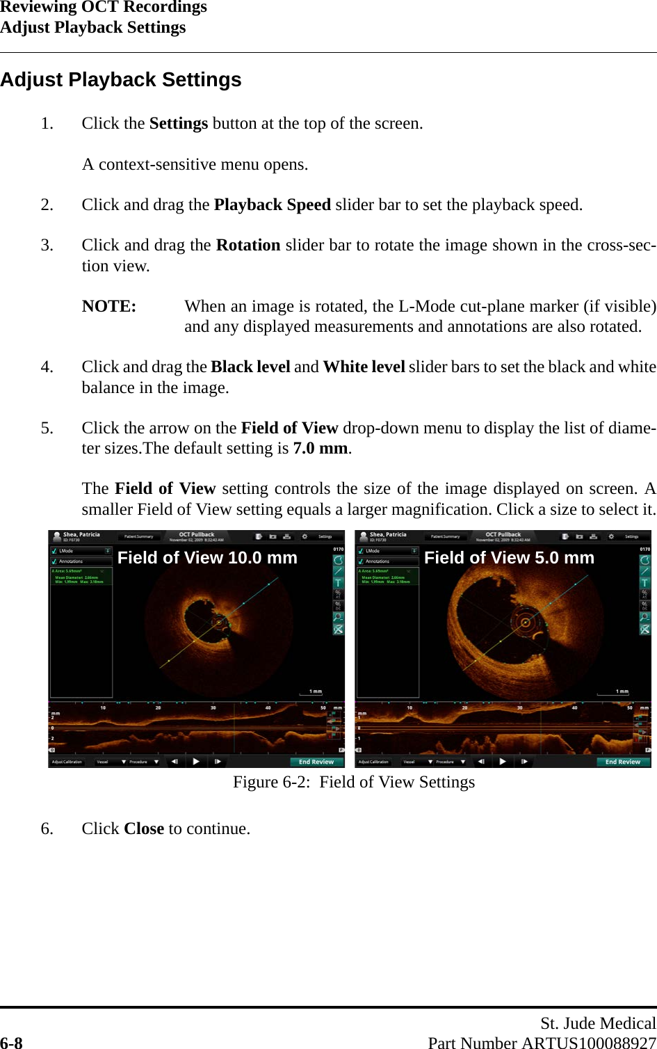 Reviewing OCT RecordingsAdjust Playback SettingsSt. Jude Medical6-8 Part Number ARTUS100088927Adjust Playback Settings1. Click the Settings button at the top of the screen.A context-sensitive menu opens.2. Click and drag the Playback Speed slider bar to set the playback speed.3. Click and drag the Rotation slider bar to rotate the image shown in the cross-sec-tion view.NOTE: When an image is rotated, the L-Mode cut-plane marker (if visible)and any displayed measurements and annotations are also rotated.4. Click and drag the Black level and White level slider bars to set the black and whitebalance in the image.5. Click the arrow on the Field of View drop-down menu to display the list of diame-ter sizes.The default setting is 7.0 mm.The Field of View setting controls the size of the image displayed on screen. Asmaller Field of View setting equals a larger magnification. Click a size to select it.6. Click Close to continue.Figure 6-2:  Field of View SettingsField of View 10.0 mm Field of View 5.0 mm