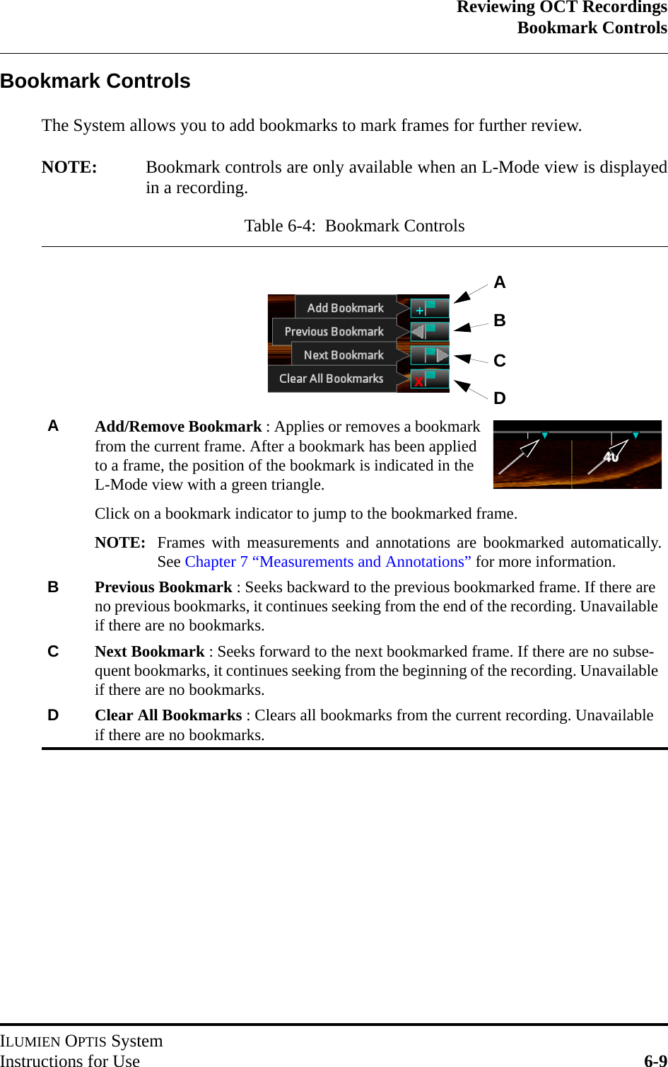 Reviewing OCT RecordingsBookmark ControlsILUMIEN OPTIS SystemInstructions for Use 6-9Bookmark ControlsThe System allows you to add bookmarks to mark frames for further review.NOTE: Bookmark controls are only available when an L-Mode view is displayedin a recording.Table 6-4:  Bookmark ControlsAAdd/Remove Bookmark : Applies or removes a bookmark from the current frame. After a bookmark has been applied to a frame, the position of the bookmark is indicated in the L-Mode view with a green triangle.Click on a bookmark indicator to jump to the bookmarked frame.NOTE: Frames with measurements and annotations are bookmarked automatically.See Chapter 7 “Measurements and Annotations” for more information.BPrevious Bookmark : Seeks backward to the previous bookmarked frame. If there are no previous bookmarks, it continues seeking from the end of the recording. Unavailable if there are no bookmarks.CNext Bookmark : Seeks forward to the next bookmarked frame. If there are no subse-quent bookmarks, it continues seeking from the beginning of the recording. Unavailable if there are no bookmarks.DClear All Bookmarks : Clears all bookmarks from the current recording. Unavailable if there are no bookmarks.ABCD