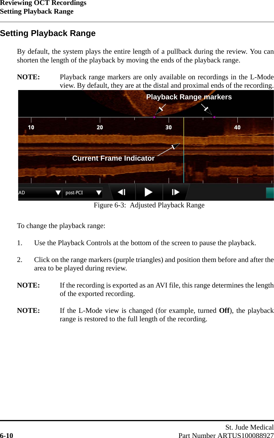 Reviewing OCT RecordingsSetting Playback RangeSt. Jude Medical6-10 Part Number ARTUS100088927Setting Playback RangeBy default, the system plays the entire length of a pullback during the review. You canshorten the length of the playback by moving the ends of the playback range.NOTE: Playback range markers are only available on recordings in the L-Modeview. By default, they are at the distal and proximal ends of the recording.To change the playback range:1. Use the Playback Controls at the bottom of the screen to pause the playback.2. Click on the range markers (purple triangles) and position them before and after thearea to be played during review.NOTE: If the recording is exported as an AVI file, this range determines the lengthof the exported recording.NOTE: If the L-Mode view is changed (for example, turned Off), the playbackrange is restored to the full length of the recording.Playback Range markersCurrent Frame IndicatorFigure 6-3:  Adjusted Playback Range