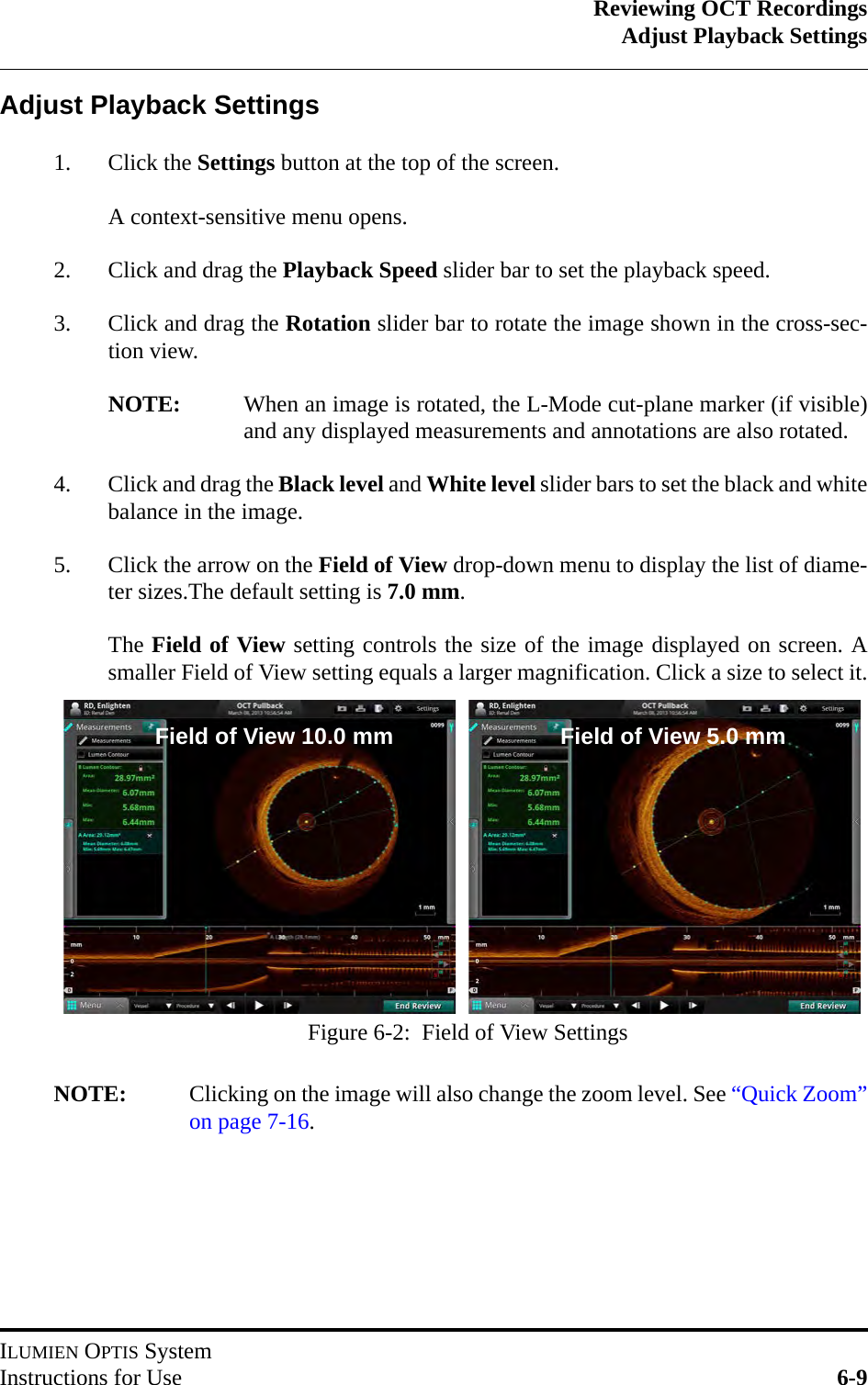 Reviewing OCT RecordingsAdjust Playback SettingsILUMIEN OPTIS SystemInstructions for Use 6-9Adjust Playback Settings1. Click the Settings button at the top of the screen.A context-sensitive menu opens.2. Click and drag the Playback Speed slider bar to set the playback speed.3. Click and drag the Rotation slider bar to rotate the image shown in the cross-sec-tion view.NOTE: When an image is rotated, the L-Mode cut-plane marker (if visible)and any displayed measurements and annotations are also rotated.4. Click and drag the Black level and White level slider bars to set the black and whitebalance in the image.5. Click the arrow on the Field of View drop-down menu to display the list of diame-ter sizes.The default setting is 7.0 mm.The Field of View setting controls the size of the image displayed on screen. Asmaller Field of View setting equals a larger magnification. Click a size to select it.NOTE: Clicking on the image will also change the zoom level. See “Quick Zoom”on page 7-16.Figure 6-2:  Field of View SettingsField of View 10.0 mm Field of View 5.0 mm