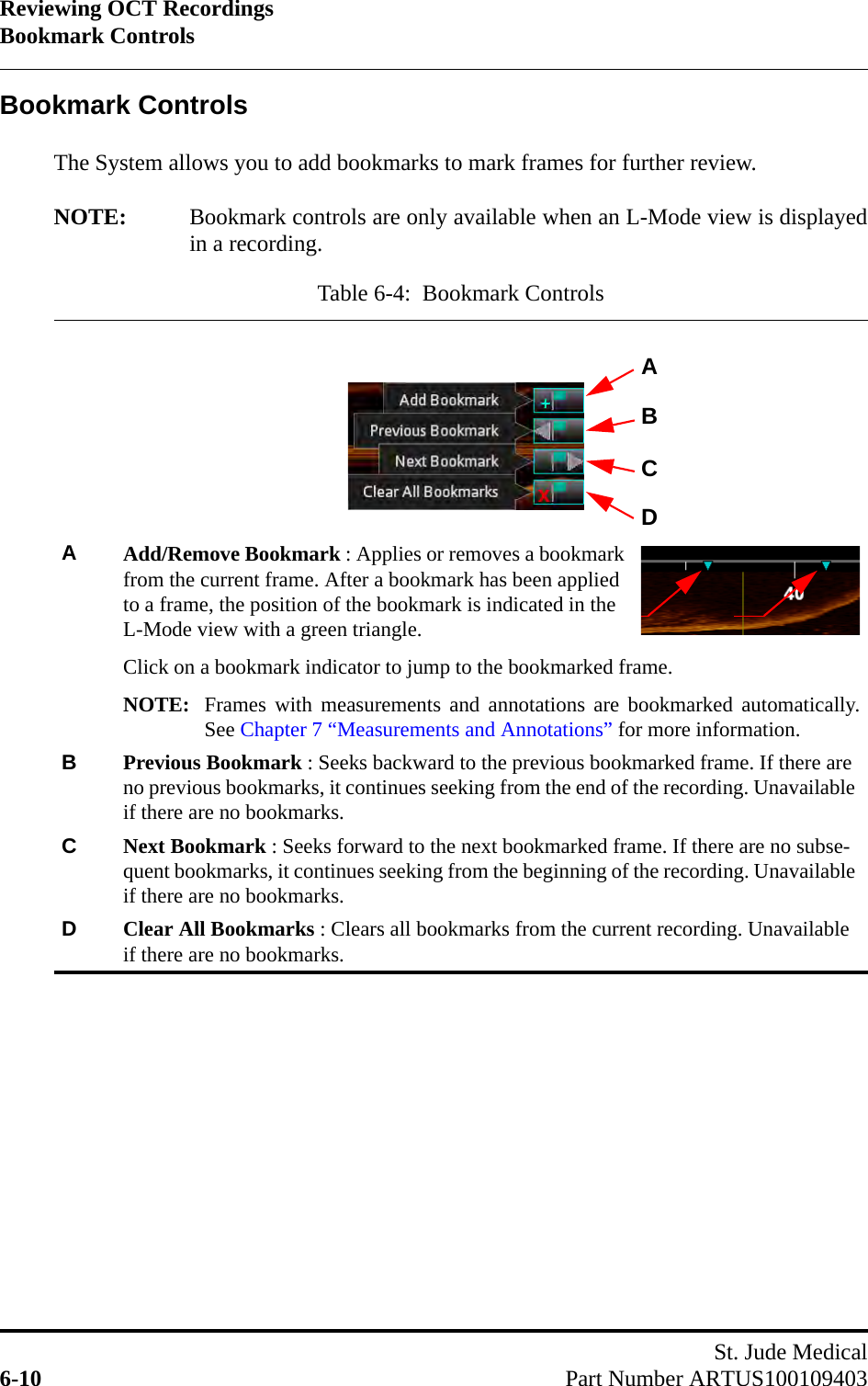 Reviewing OCT RecordingsBookmark ControlsSt. Jude Medical6-10 Part Number ARTUS100109403Bookmark ControlsThe System allows you to add bookmarks to mark frames for further review.NOTE: Bookmark controls are only available when an L-Mode view is displayedin a recording.Table 6-4:  Bookmark ControlsAAdd/Remove Bookmark : Applies or removes a bookmark from the current frame. After a bookmark has been applied to a frame, the position of the bookmark is indicated in the L-Mode view with a green triangle.Click on a bookmark indicator to jump to the bookmarked frame.NOTE: Frames with measurements and annotations are bookmarked automatically.See Chapter 7 “Measurements and Annotations” for more information.BPrevious Bookmark : Seeks backward to the previous bookmarked frame. If there are no previous bookmarks, it continues seeking from the end of the recording. Unavailable if there are no bookmarks.CNext Bookmark : Seeks forward to the next bookmarked frame. If there are no subse-quent bookmarks, it continues seeking from the beginning of the recording. Unavailable if there are no bookmarks.DClear All Bookmarks : Clears all bookmarks from the current recording. Unavailable if there are no bookmarks.ABCD