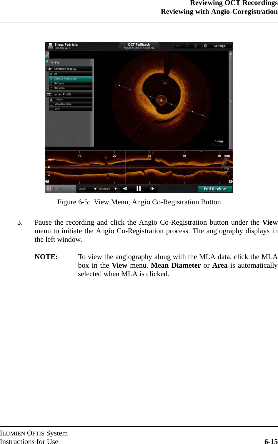 Reviewing OCT RecordingsReviewing with Angio-CoregistrationILUMIEN OPTIS SystemInstructions for Use 6-153. Pause the recording and click the Angio Co-Registration button under the Viewmenu to initiate the Angio Co-Registration process. The angiography displays inthe left window.NOTE: To view the angiography along with the MLA data, click the MLAbox in the View menu. Mean Diameter or Area is automaticallyselected when MLA is clicked.Figure 6-5:  View Menu, Angio Co-Registration Button