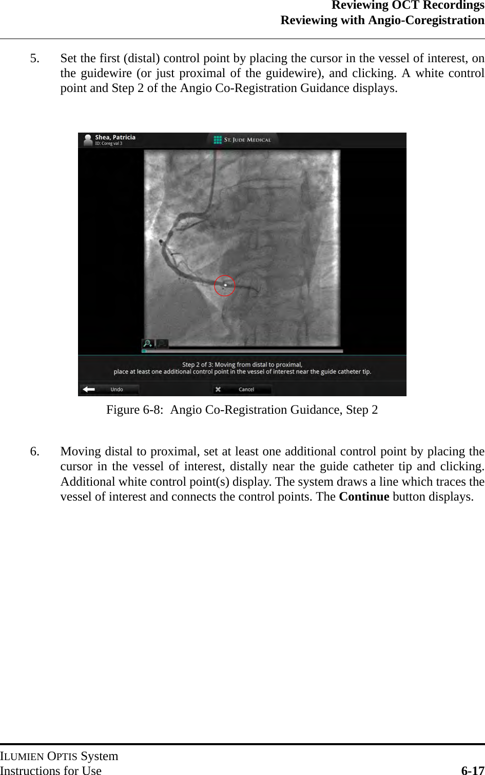 Reviewing OCT RecordingsReviewing with Angio-CoregistrationILUMIEN OPTIS SystemInstructions for Use 6-175. Set the first (distal) control point by placing the cursor in the vessel of interest, onthe guidewire (or just proximal of the guidewire), and clicking. A white controlpoint and Step 2 of the Angio Co-Registration Guidance displays.6. Moving distal to proximal, set at least one additional control point by placing thecursor in the vessel of interest, distally near the guide catheter tip and clicking.Additional white control point(s) display. The system draws a line which traces thevessel of interest and connects the control points. The Continue button displays.Figure 6-8:  Angio Co-Registration Guidance, Step 2