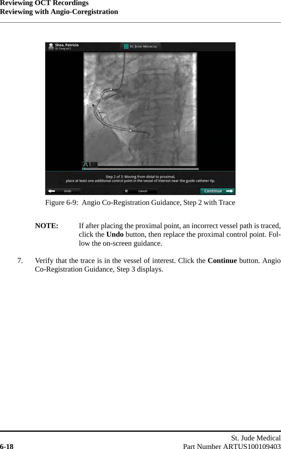 Reviewing OCT RecordingsReviewing with Angio-CoregistrationSt. Jude Medical6-18 Part Number ARTUS100109403NOTE: If after placing the proximal point, an incorrect vessel path is traced,click the Undo button, then replace the proximal control point. Fol-low the on-screen guidance.7. Verify that the trace is in the vessel of interest. Click the Continue button. AngioCo-Registration Guidance, Step 3 displays.Figure 6-9:  Angio Co-Registration Guidance, Step 2 with Trace