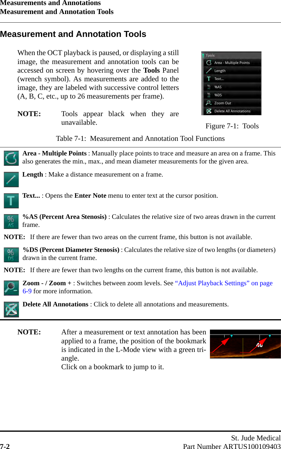 Measurements and AnnotationsMeasurement and Annotation ToolsSt. Jude Medical7-2 Part Number ARTUS100109403Measurement and Annotation ToolsWhen the OCT playback is paused, or displaying a stillimage, the measurement and annotation tools can beaccessed on screen by hovering over the Tools Panel(wrench symbol). As measurements are added to theimage, they are labeled with successive control letters(A, B, C, etc., up to 26 measurements per frame).NOTE: Tools appear black when they areunavailable.NOTE: After a measurement or text annotation has beenapplied to a frame, the position of the bookmarkis indicated in the L-Mode view with a green tri-angle.Click on a bookmark to jump to it.Table 7-1:  Measurement and Annotation Tool FunctionsArea - Multiple Points : Manually place points to trace and measure an area on a frame. This also generates the min., max., and mean diameter measurements for the given area.Length : Make a distance measurement on a frame.Text... : Opens the Enter Note menu to enter text at the cursor position.%AS (Percent Area Stenosis) : Calculates the relative size of two areas drawn in the current frame.NOTE: If there are fewer than two areas on the current frame, this button is not available.%DS (Percent Diameter Stenosis) : Calculates the relative size of two lengths (or diameters) drawn in the current frame.NOTE: If there are fewer than two lengths on the current frame, this button is not available.Zoom - / Zoom + : Switches between zoom levels. See “Adjust Playback Settings” on page 6-9 for more information.Delete All Annotations : Click to delete all annotations and measurements.Figure 7-1:  Tools