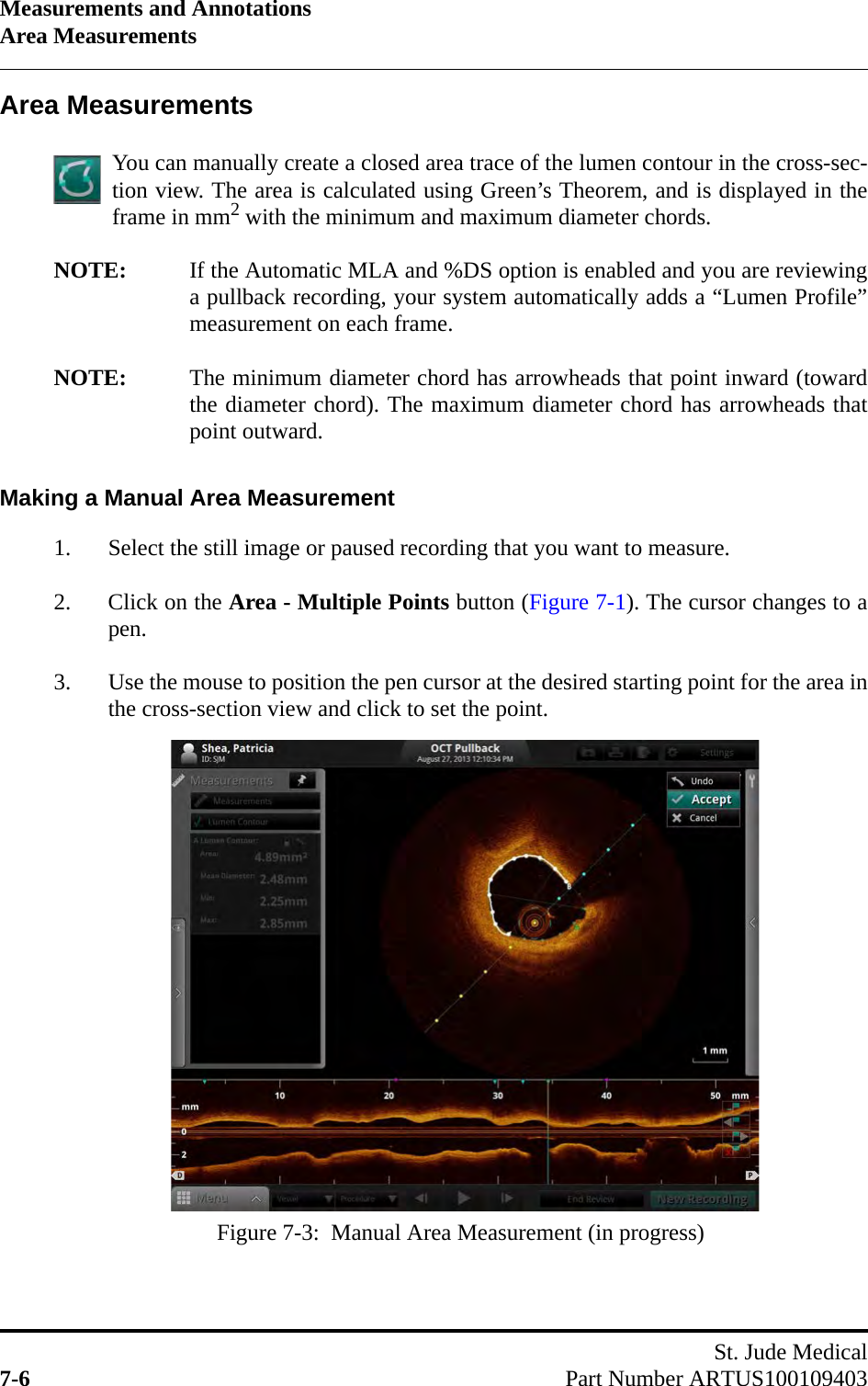 Measurements and AnnotationsArea MeasurementsSt. Jude Medical7-6 Part Number ARTUS100109403Area MeasurementsYou can manually create a closed area trace of the lumen contour in the cross-sec-tion view. The area is calculated using Green’s Theorem, and is displayed in theframe in mm2 with the minimum and maximum diameter chords.NOTE: If the Automatic MLA and %DS option is enabled and you are reviewinga pullback recording, your system automatically adds a “Lumen Profile”measurement on each frame.NOTE: The minimum diameter chord has arrowheads that point inward (towardthe diameter chord). The maximum diameter chord has arrowheads thatpoint outward.Making a Manual Area Measurement1. Select the still image or paused recording that you want to measure.2. Click on the Area - Multiple Points button (Figure 7-1). The cursor changes to apen.3. Use the mouse to position the pen cursor at the desired starting point for the area inthe cross-section view and click to set the point.Figure 7-3:  Manual Area Measurement (in progress)