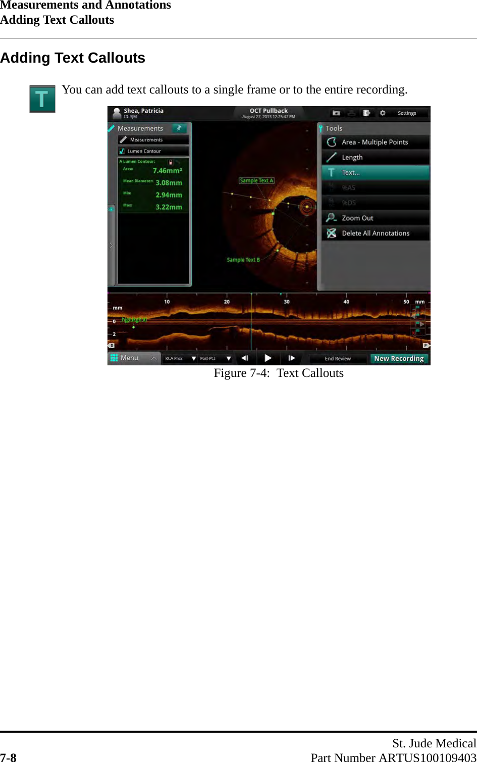 Measurements and AnnotationsAdding Text CalloutsSt. Jude Medical7-8 Part Number ARTUS100109403Adding Text CalloutsYou can add text callouts to a single frame or to the entire recording.Figure 7-4:  Text Callouts