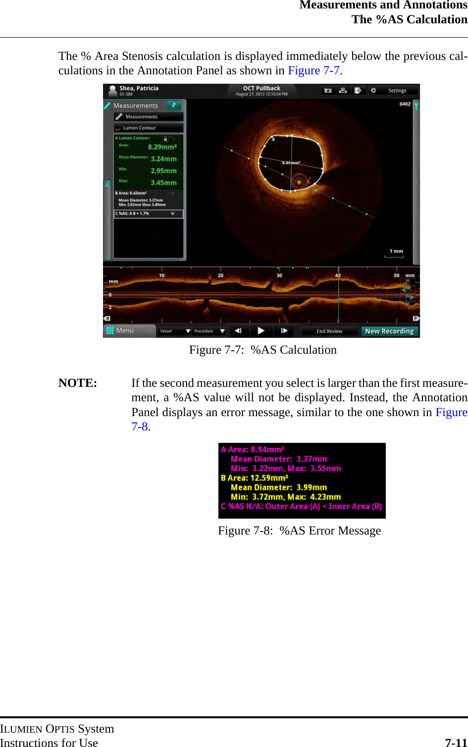 Measurements and AnnotationsThe %AS CalculationILUMIEN OPTIS SystemInstructions for Use 7-11The % Area Stenosis calculation is displayed immediately below the previous cal-culations in the Annotation Panel as shown in Figure 7-7.NOTE: If the second measurement you select is larger than the first measure-ment, a %AS value will not be displayed. Instead, the AnnotationPanel displays an error message, similar to the one shown in Figure7-8.Figure 7-7:  %AS CalculationFigure 7-8:  %AS Error Message