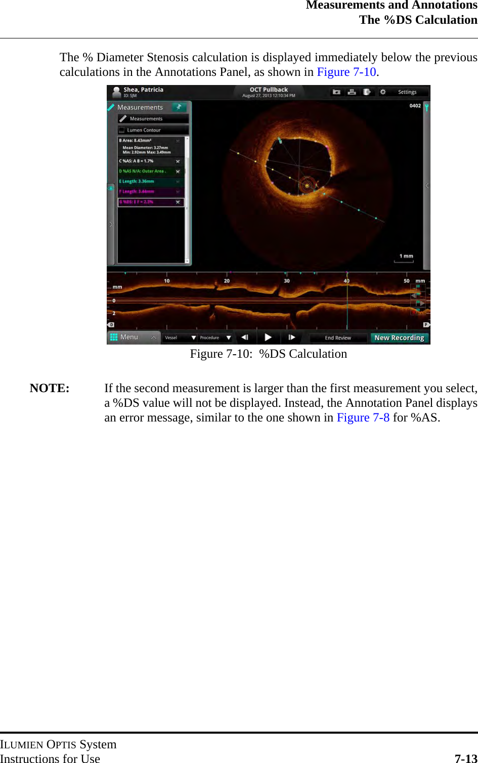 Measurements and AnnotationsThe %DS CalculationILUMIEN OPTIS SystemInstructions for Use 7-13The % Diameter Stenosis calculation is displayed immediately below the previouscalculations in the Annotations Panel, as shown in Figure 7-10.NOTE: If the second measurement is larger than the first measurement you select,a %DS value will not be displayed. Instead, the Annotation Panel displaysan error message, similar to the one shown in Figure 7-8 for %AS.Figure 7-10:  %DS Calculation