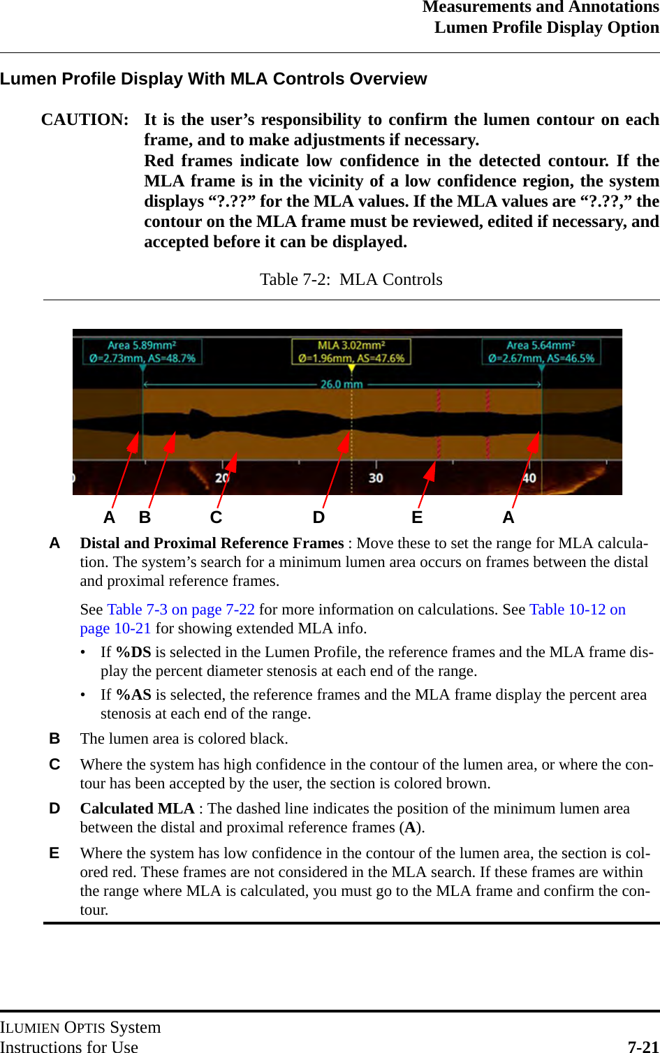 Measurements and AnnotationsLumen Profile Display OptionILUMIEN OPTIS SystemInstructions for Use 7-21Lumen Profile Display With MLA Controls OverviewCAUTION: It is the user’s responsibility to confirm the lumen contour on eachframe, and to make adjustments if necessary.  Red frames indicate low confidence in the detected contour. If theMLA frame is in the vicinity of a low confidence region, the systemdisplays “?.??” for the MLA values. If the MLA values are “?.??,” thecontour on the MLA frame must be reviewed, edited if necessary, andaccepted before it can be displayed.Table 7-2:  MLA ControlsADistal and Proximal Reference Frames : Move these to set the range for MLA calcula-tion. The system’s search for a minimum lumen area occurs on frames between the distal and proximal reference frames.See Table 7-3 on page 7-22 for more information on calculations. See Table 10-12 on page 10-21 for showing extended MLA info.• If %DS is selected in the Lumen Profile, the reference frames and the MLA frame dis-play the percent diameter stenosis at each end of the range.• If %AS is selected, the reference frames and the MLA frame display the percent area stenosis at each end of the range.BThe lumen area is colored black.CWhere the system has high confidence in the contour of the lumen area, or where the con-tour has been accepted by the user, the section is colored brown.DCalculated MLA : The dashed line indicates the position of the minimum lumen area between the distal and proximal reference frames (A).EWhere the system has low confidence in the contour of the lumen area, the section is col-ored red. These frames are not considered in the MLA search. If these frames are within the range where MLA is calculated, you must go to the MLA frame and confirm the con-tour.BCEA D A