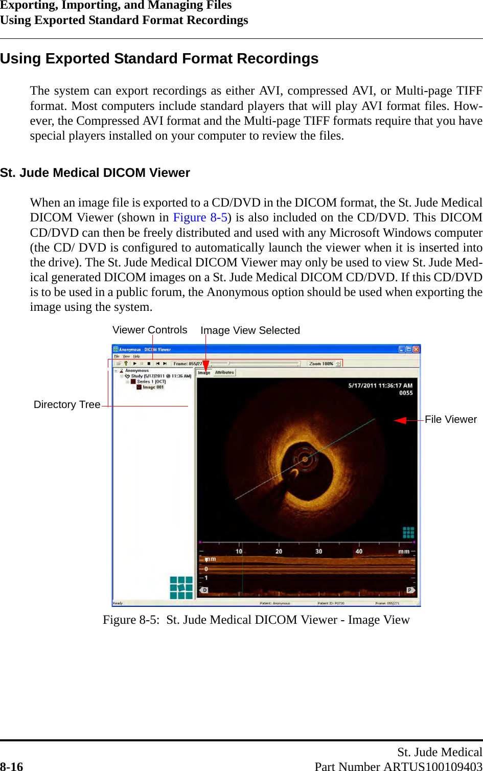 Exporting, Importing, and Managing FilesUsing Exported Standard Format RecordingsSt. Jude Medical8-16 Part Number ARTUS100109403Using Exported Standard Format RecordingsThe system can export recordings as either AVI, compressed AVI, or Multi-page TIFFformat. Most computers include standard players that will play AVI format files. How-ever, the Compressed AVI format and the Multi-page TIFF formats require that you havespecial players installed on your computer to review the files.St. Jude Medical DICOM ViewerWhen an image file is exported to a CD/DVD in the DICOM format, the St. Jude MedicalDICOM Viewer (shown in Figure 8-5) is also included on the CD/DVD. This DICOMCD/DVD can then be freely distributed and used with any Microsoft Windows computer(the CD/ DVD is configured to automatically launch the viewer when it is inserted intothe drive). The St. Jude Medical DICOM Viewer may only be used to view St. Jude Med-ical generated DICOM images on a St. Jude Medical DICOM CD/DVD. If this CD/DVDis to be used in a public forum, the Anonymous option should be used when exporting theimage using the system.Figure 8-5:  St. Jude Medical DICOM Viewer - Image ViewViewer ControlsFile ViewerDirectory TreeImage View Selected