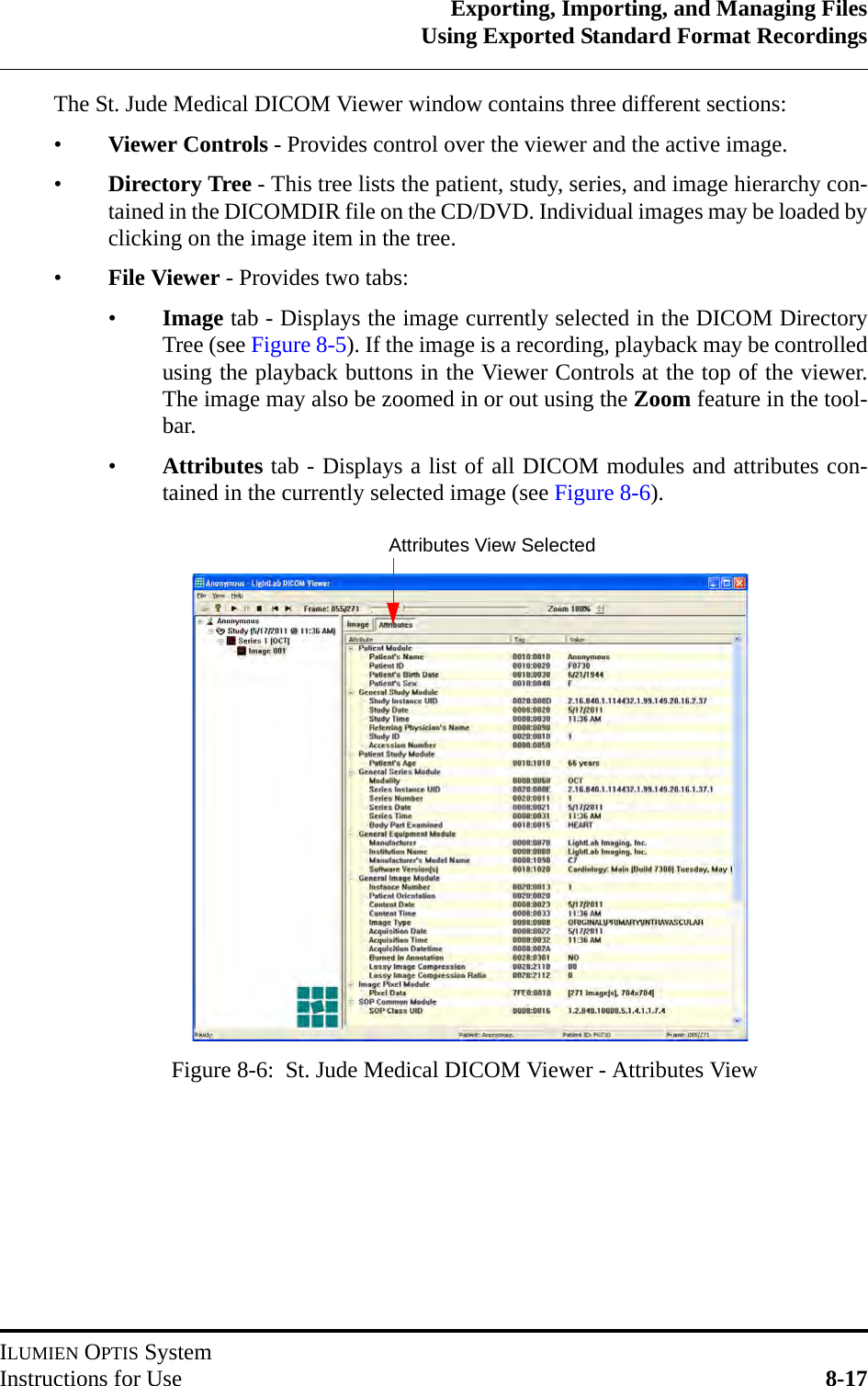 Exporting, Importing, and Managing FilesUsing Exported Standard Format RecordingsILUMIEN OPTIS SystemInstructions for Use 8-17The St. Jude Medical DICOM Viewer window contains three different sections:•Viewer Controls - Provides control over the viewer and the active image.•Directory Tree - This tree lists the patient, study, series, and image hierarchy con-tained in the DICOMDIR file on the CD/DVD. Individual images may be loaded byclicking on the image item in the tree.•File Viewer - Provides two tabs:•Image tab - Displays the image currently selected in the DICOM DirectoryTree (see Figure 8-5). If the image is a recording, playback may be controlledusing the playback buttons in the Viewer Controls at the top of the viewer.The image may also be zoomed in or out using the Zoom feature in the tool-bar.•Attributes tab - Displays a list of all DICOM modules and attributes con-tained in the currently selected image (see Figure 8-6).Figure 8-6:  St. Jude Medical DICOM Viewer - Attributes ViewAttributes View Selected