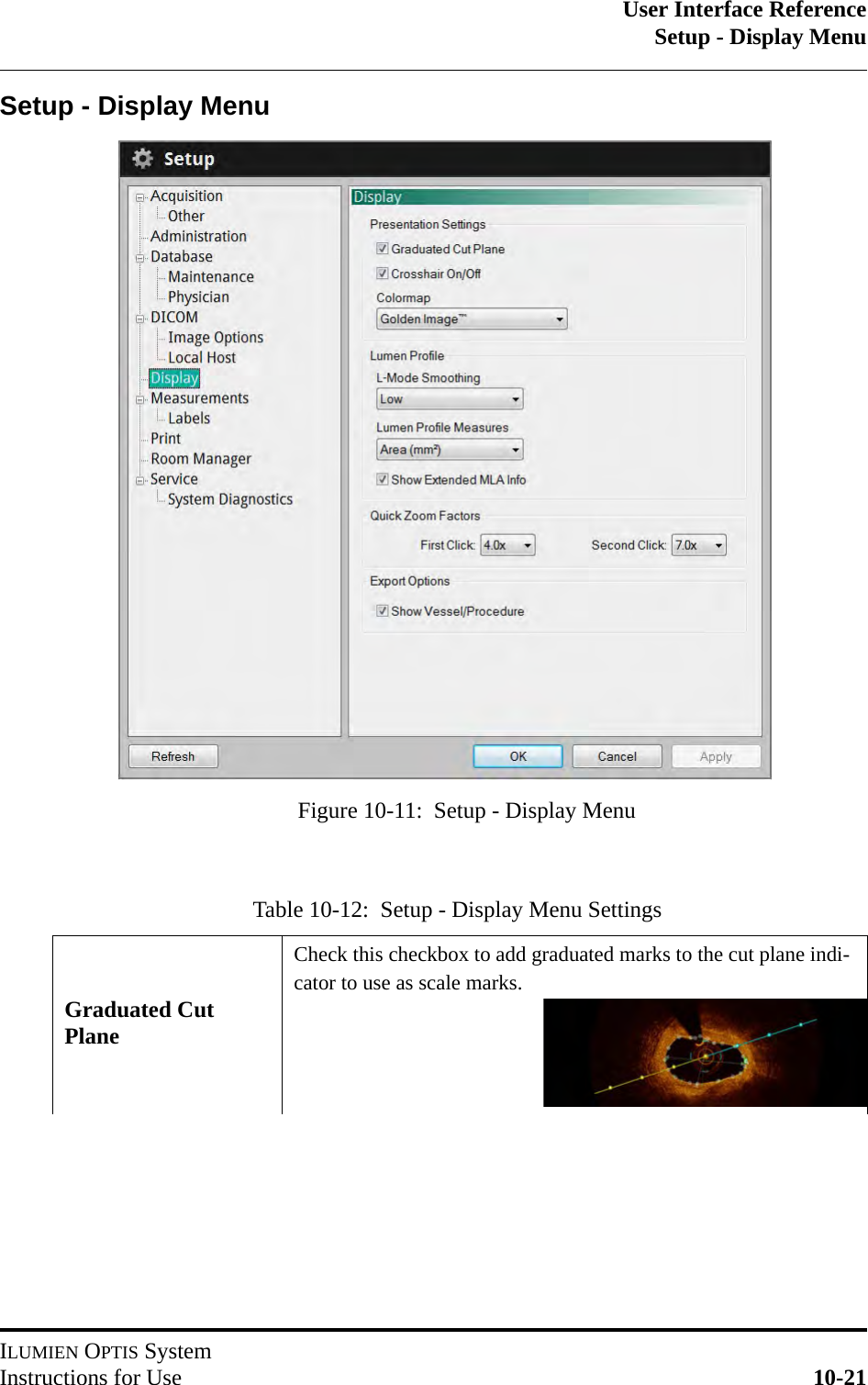 User Interface ReferenceSetup - Display MenuILUMIEN OPTIS SystemInstructions for Use 10-21Setup - Display MenuTable 10-12:  Setup - Display Menu SettingsGraduated Cut PlaneCheck this checkbox to add graduated marks to the cut plane indi-cator to use as scale marks.Figure 10-11:  Setup - Display Menu