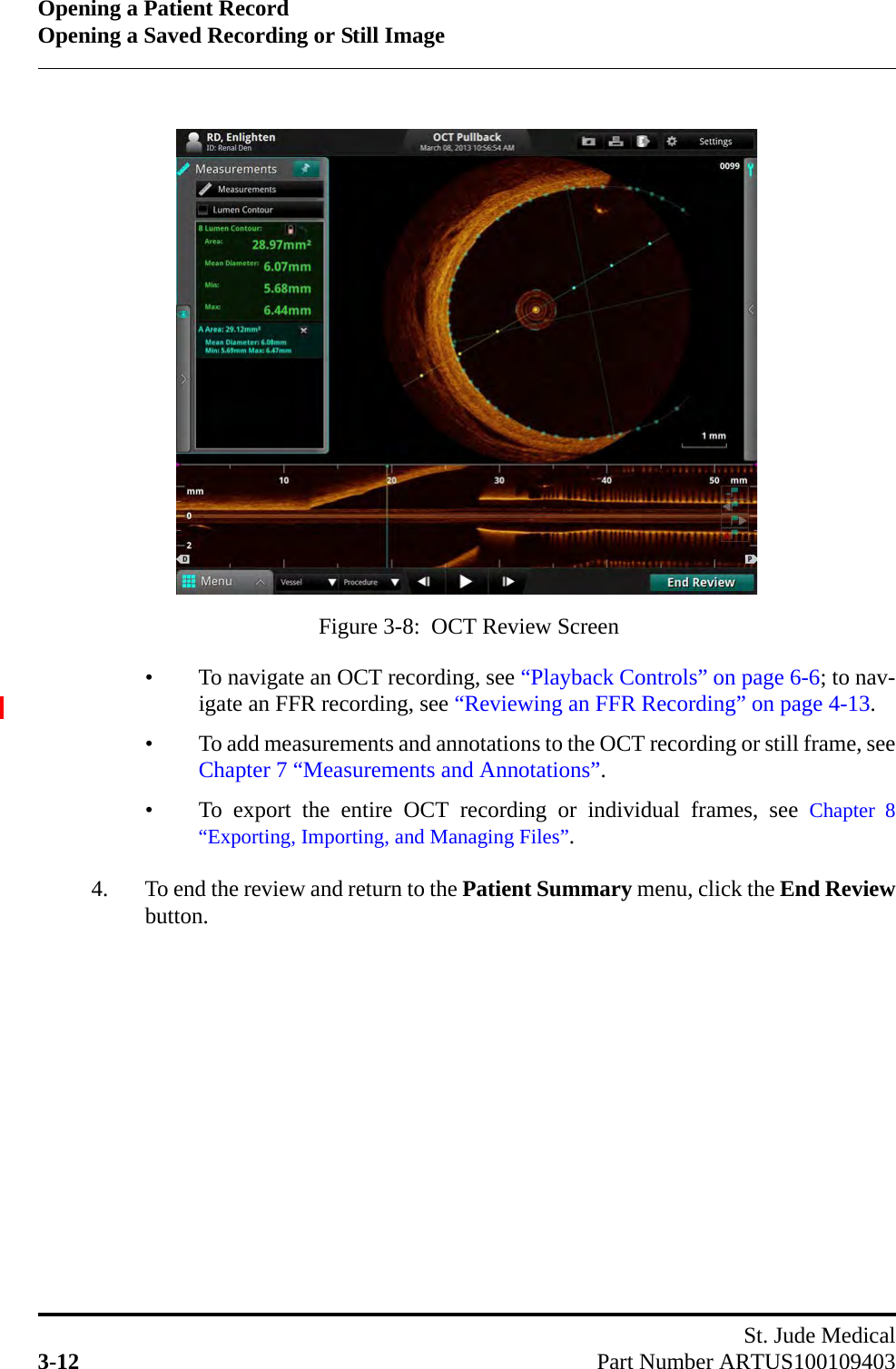 Opening a Patient RecordOpening a Saved Recording or Still ImageSt. Jude Medical3-12 Part Number ARTUS100109403• To navigate an OCT recording, see “Playback Controls” on page 6-6; to nav-igate an FFR recording, see “Reviewing an FFR Recording” on page 4-13.• To add measurements and annotations to the OCT recording or still frame, seeChapter 7 “Measurements and Annotations”.• To export the entire OCT recording or individual frames, see Chapter 8“Exporting, Importing, and Managing Files”.4. To end the review and return to the Patient Summary menu, click the End Reviewbutton.Figure 3-8:  OCT Review Screen