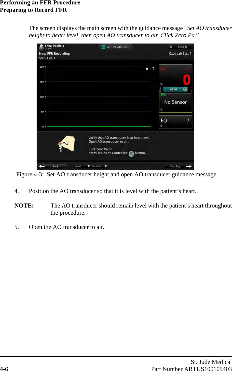 Performing an FFR ProcedurePreparing to Record FFRSt. Jude Medical4-6 Part Number ARTUS100109403The screen displays the main screen with the guidance message “Set AO transducerheight to heart level, then open AO transducer to air. Click Zero Pa.”4. Position the AO transducer so that it is level with the patient’s heart.NOTE: The AO transducer should remain level with the patient’s heart throughoutthe procedure.5. Open the AO transducer to air.Figure 4-3:  Set AO transducer height and open AO transducer guidance message