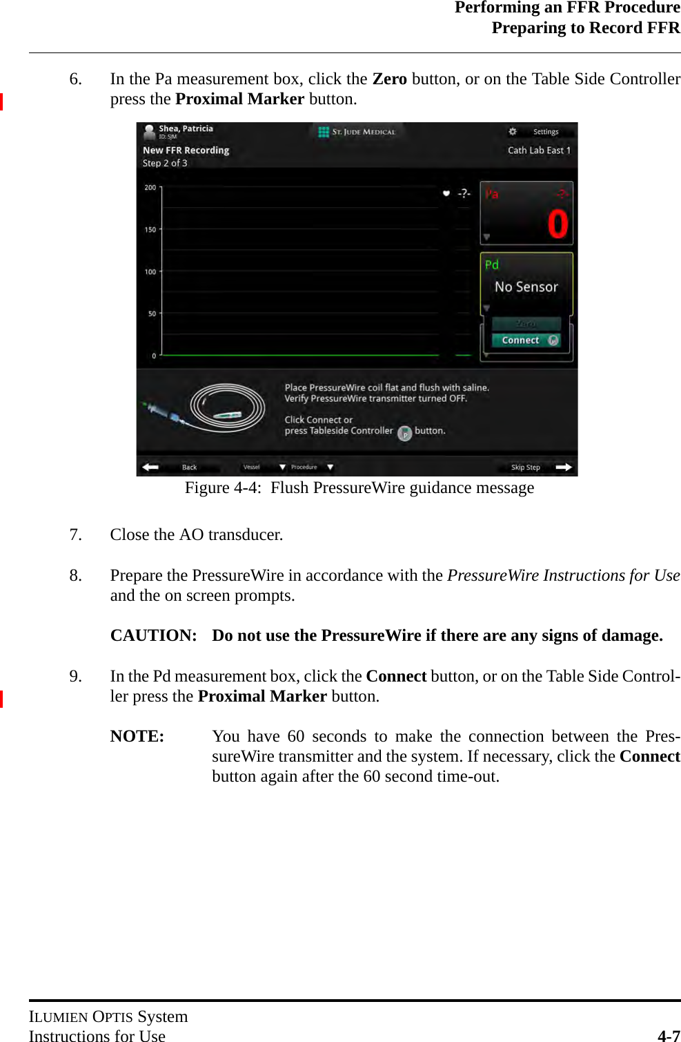 Performing an FFR ProcedurePreparing to Record FFRILUMIEN OPTIS SystemInstructions for Use 4-76. In the Pa measurement box, click the Zero button, or on the Table Side Controllerpress the Proximal Marker button. 7. Close the AO transducer.8. Prepare the PressureWire in accordance with the PressureWire Instructions for Useand the on screen prompts.CAUTION: Do not use the PressureWire if there are any signs of damage.9. In the Pd measurement box, click the Connect button, or on the Table Side Control-ler press the Proximal Marker button.NOTE: You have 60 seconds to make the connection between the Pres-sureWire transmitter and the system. If necessary, click the Connectbutton again after the 60 second time-out.Figure 4-4:  Flush PressureWire guidance message