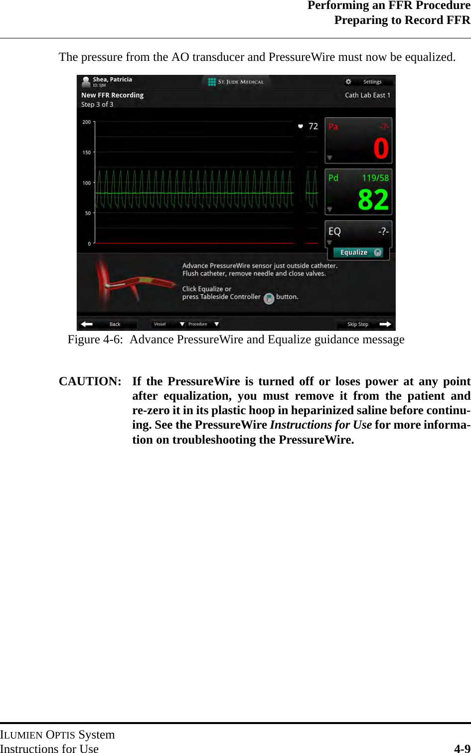 Performing an FFR ProcedurePreparing to Record FFRILUMIEN OPTIS SystemInstructions for Use 4-9The pressure from the AO transducer and PressureWire must now be equalized.CAUTION: If the PressureWire is turned off or loses power at any pointafter equalization, you must remove it from the patient andre-zero it in its plastic hoop in heparinized saline before continu-ing. See the PressureWire Instructions for Use for more informa-tion on troubleshooting the PressureWire.Figure 4-6:  Advance PressureWire and Equalize guidance message