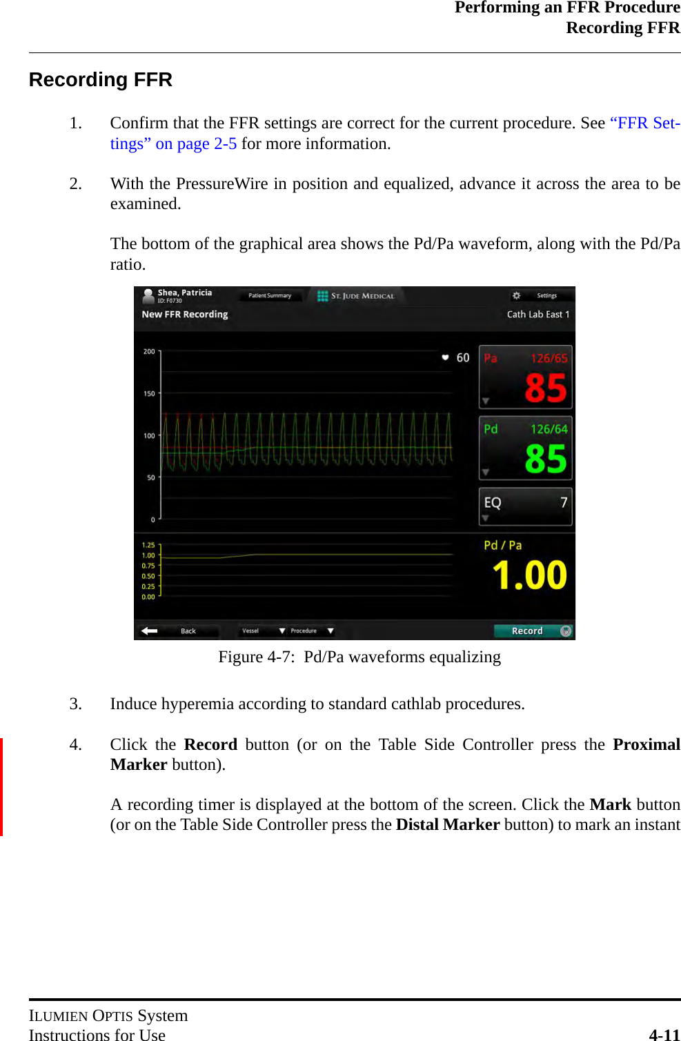 Performing an FFR ProcedureRecording FFRILUMIEN OPTIS SystemInstructions for Use 4-11Recording FFR1. Confirm that the FFR settings are correct for the current procedure. See “FFR Set-tings” on page 2-5 for more information.2. With the PressureWire in position and equalized, advance it across the area to beexamined.The bottom of the graphical area shows the Pd/Pa waveform, along with the Pd/Paratio.3. Induce hyperemia according to standard cathlab procedures.4. Click the Record button (or on the Table Side Controller press the ProximalMarker button).A recording timer is displayed at the bottom of the screen. Click the Mark button(or on the Table Side Controller press the Distal Marker button) to mark an instantFigure 4-7:  Pd/Pa waveforms equalizing