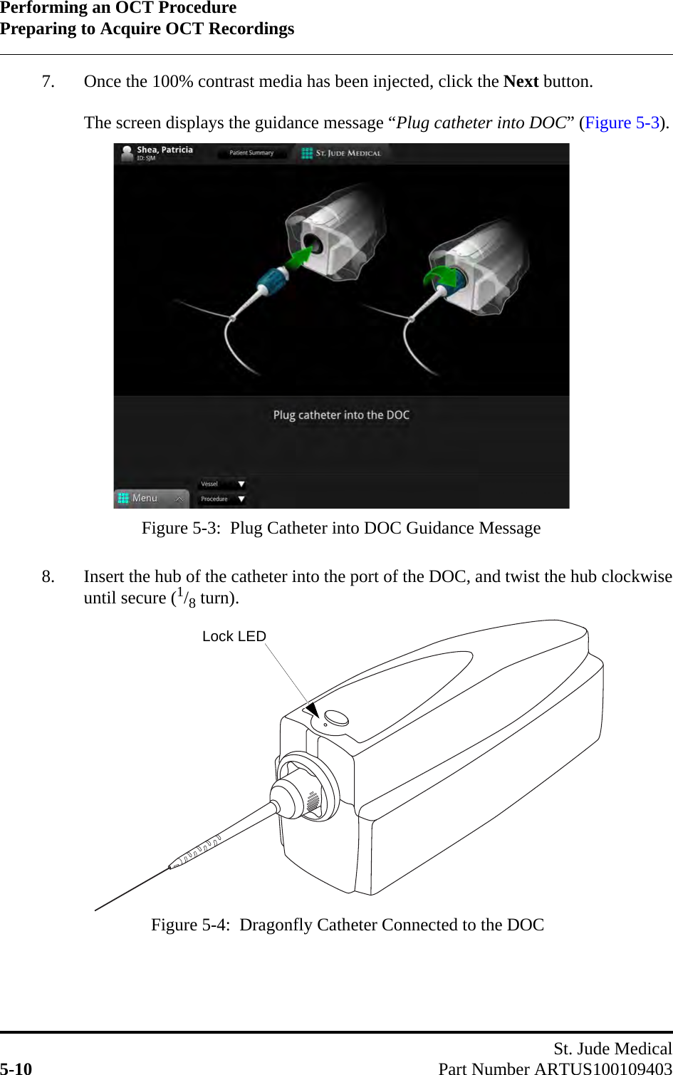 Performing an OCT ProcedurePreparing to Acquire OCT RecordingsSt. Jude Medical5-10 Part Number ARTUS1001094037. Once the 100% contrast media has been injected, click the Next button.The screen displays the guidance message “Plug catheter into DOC” (Figure 5-3).8. Insert the hub of the catheter into the port of the DOC, and twist the hub clockwiseuntil secure (1/8 turn).Figure 5-3:  Plug Catheter into DOC Guidance MessageFigure 5-4:  Dragonfly Catheter Connected to the DOCLock LED