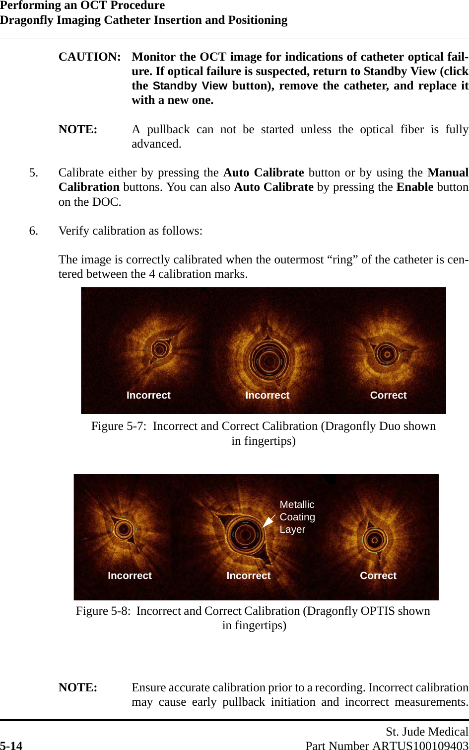 Performing an OCT ProcedureDragonfly Imaging Catheter Insertion and PositioningSt. Jude Medical5-14 Part Number ARTUS100109403CAUTION: Monitor the OCT image for indications of catheter optical fail-ure. If optical failure is suspected, return to Standby View (clickthe Standby View button), remove the catheter, and replace itwith a new one.NOTE: A pullback can not be started unless the optical fiber is fullyadvanced.5. Calibrate either by pressing the Auto Calibrate button or by using the ManualCalibration buttons. You can also Auto Calibrate by pressing the Enable buttonon the DOC.6. Verify calibration as follows:The image is correctly calibrated when the outermost “ring” of the catheter is cen-tered between the 4 calibration marks. NOTE: Ensure accurate calibration prior to a recording. Incorrect calibrationmay cause early pullback initiation and incorrect measurements.Figure 5-7:  Incorrect and Correct Calibration (Dragonfly Duo shown in fingertips)Incorrect                          Incorrect                            CorrectIncorrect                          Incorrect                               CorrectFigure 5-8:  Incorrect and Correct Calibration (Dragonfly OPTIS shown in fingertips) Metallic Coating Layer 
