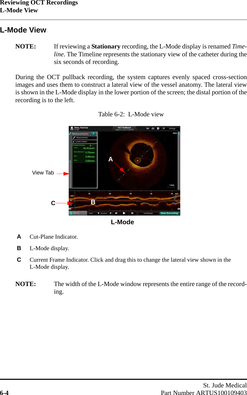 Reviewing OCT RecordingsL-Mode ViewSt. Jude Medical6-4 Part Number ARTUS100109403L-Mode ViewNOTE: If reviewing a Stationary recording, the L-Mode display is renamed Time-line. The Timeline represents the stationary view of the catheter during thesix seconds of recording.During the OCT pullback recording, the system captures evenly spaced cross-sectionimages and uses them to construct a lateral view of the vessel anatomy. The lateral viewis shown in the L-Mode display in the lower portion of the screen; the distal portion of therecording is to the left.NOTE: The width of the L-Mode window represents the entire range of the record-ing.Table 6-2:  L-Mode viewACut-Plane Indicator.  BL-Mode display.CCurrent Frame Indicator. Click and drag this to change the lateral view shown in the L-Mode display.BAL-ModeView TabC