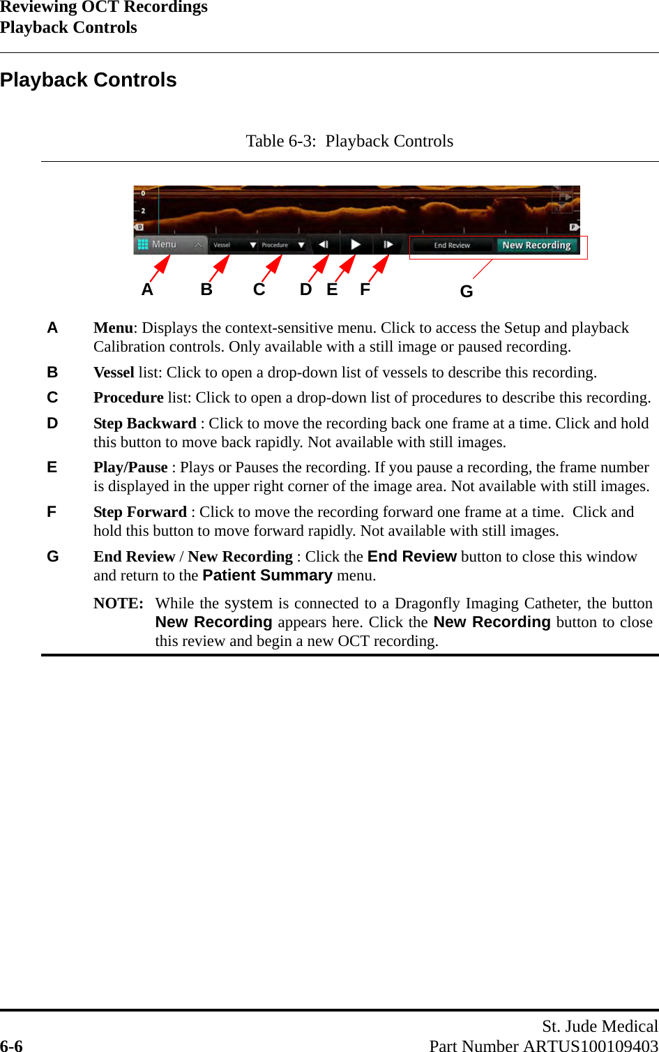 Reviewing OCT RecordingsPlayback ControlsSt. Jude Medical6-6 Part Number ARTUS100109403Playback ControlsTable 6-3:  Playback ControlsAMenu: Displays the context-sensitive menu. Click to access the Setup and playback Calibration controls. Only available with a still image or paused recording.BVessel list: Click to open a drop-down list of vessels to describe this recording.CProcedure list: Click to open a drop-down list of procedures to describe this recording.DStep Backward : Click to move the recording back one frame at a time. Click and hold this button to move back rapidly. Not available with still images.EPlay/Pause : Plays or Pauses the recording. If you pause a recording, the frame number is displayed in the upper right corner of the image area. Not available with still images.FStep Forward : Click to move the recording forward one frame at a time.  Click and hold this button to move forward rapidly. Not available with still images.GEnd Review / New Recording : Click the End Review button to close this window and return to the Patient Summary menu.NOTE: While the system is connected to a Dragonfly Imaging Catheter, the buttonNew Recording appears here. Click the New Recording button to closethis review and begin a new OCT recording.A E F GB C DXX