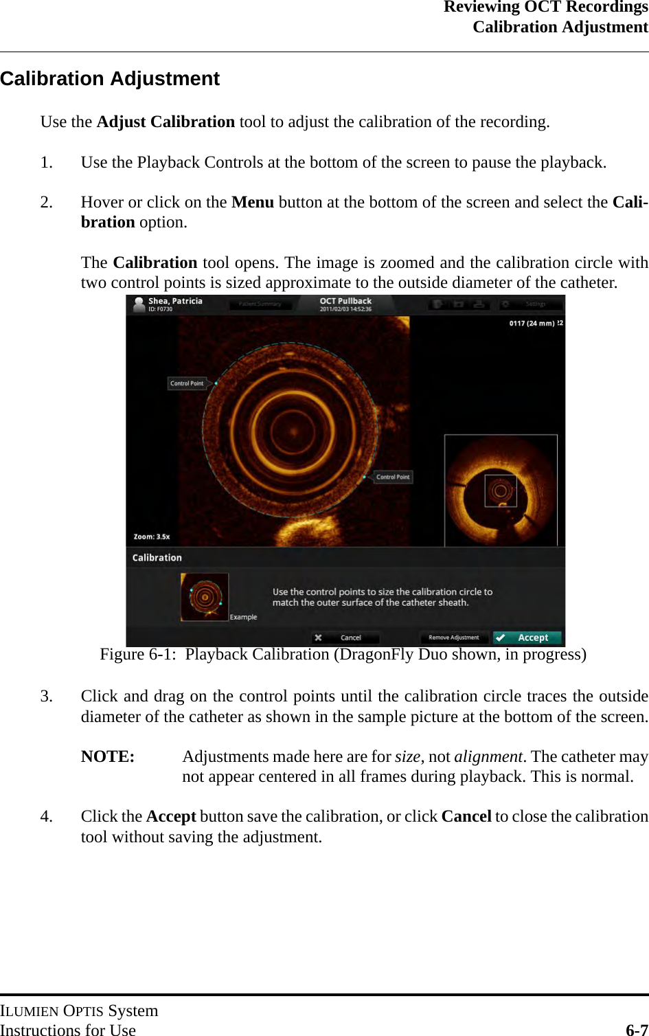 Reviewing OCT RecordingsCalibration AdjustmentILUMIEN OPTIS SystemInstructions for Use 6-7Calibration AdjustmentUse the Adjust Calibration tool to adjust the calibration of the recording.1. Use the Playback Controls at the bottom of the screen to pause the playback.2. Hover or click on the Menu button at the bottom of the screen and select the Cali-bration option.The Calibration tool opens. The image is zoomed and the calibration circle withtwo control points is sized approximate to the outside diameter of the catheter.3. Click and drag on the control points until the calibration circle traces the outsidediameter of the catheter as shown in the sample picture at the bottom of the screen.NOTE: Adjustments made here are for size, not alignment. The catheter maynot appear centered in all frames during playback. This is normal.4. Click the Accept button save the calibration, or click Cancel to close the calibrationtool without saving the adjustment.Figure 6-1:  Playback Calibration (DragonFly Duo shown, in progress)