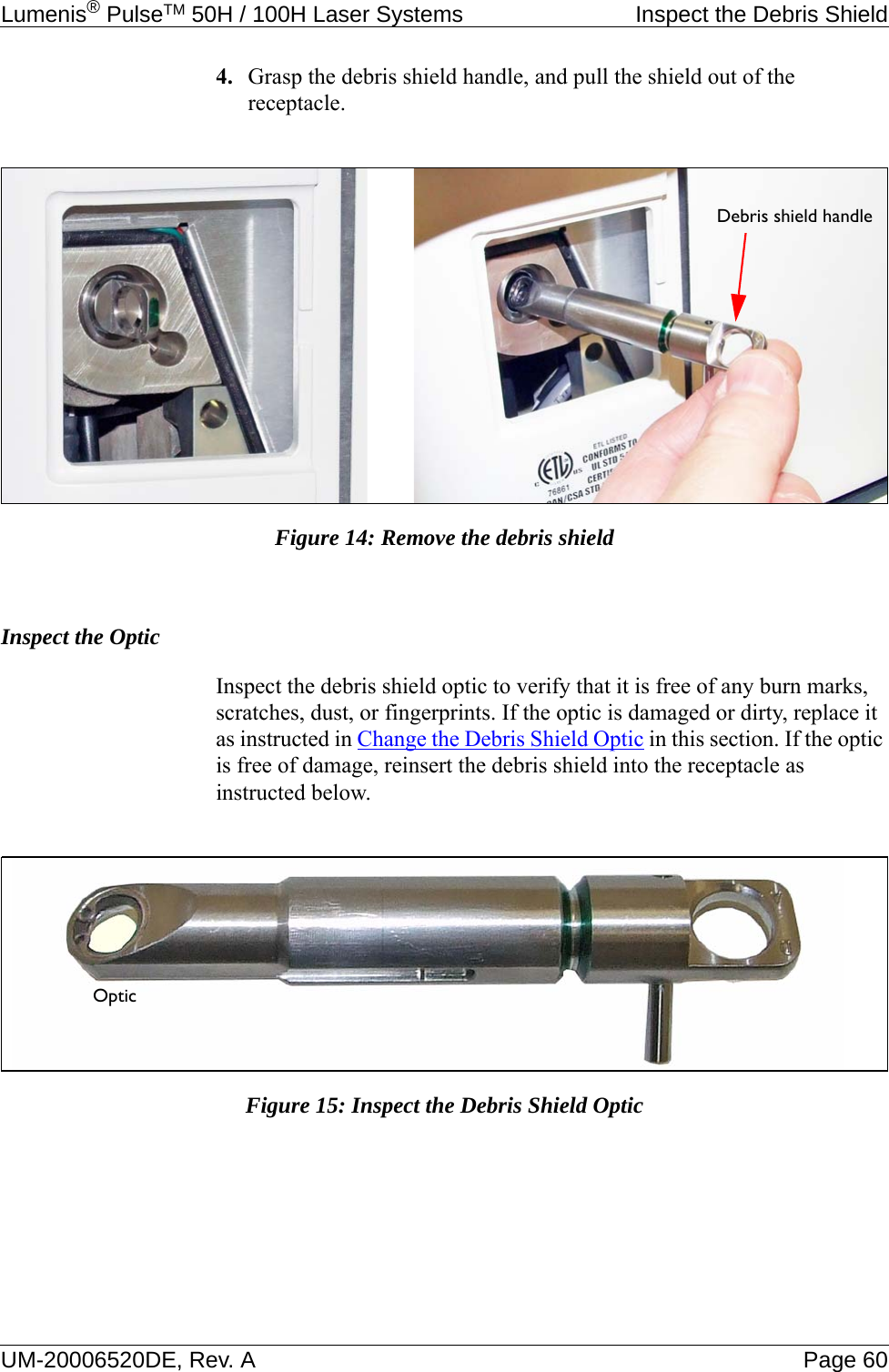 Lumenis® PulseTM 50H / 100H Laser Systems  Inspect the Debris ShieldUM-20006520DE, Rev. A Page 604. Grasp the debris shield handle, and pull the shield out of the receptacle. Figure 14: Remove the debris shieldInspect the OpticInspect the debris shield optic to verify that it is free of any burn marks, scratches, dust, or fingerprints. If the optic is damaged or dirty, replace it as instructed in Change the Debris Shield Optic in this section. If the optic is free of damage, reinsert the debris shield into the receptacle as instructed below.Figure 15: Inspect the Debris Shield OpticDebris shield handleOptic