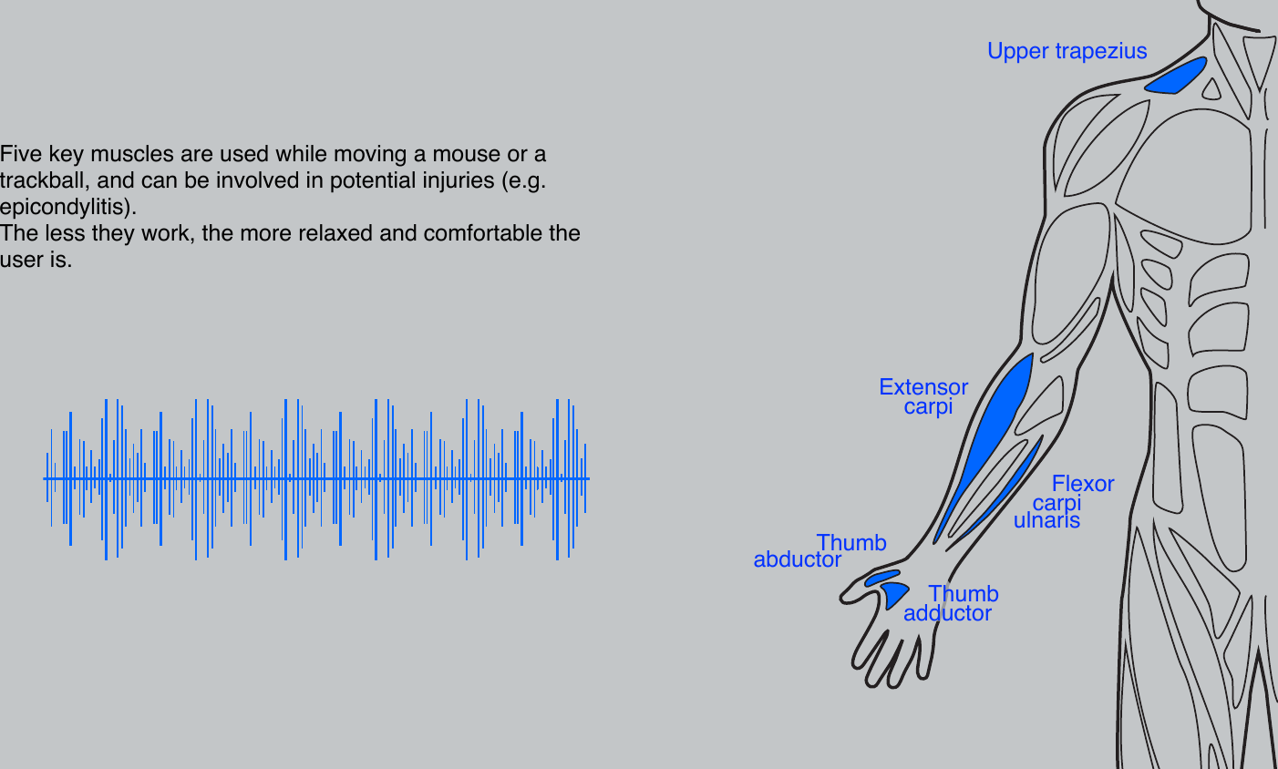 Five key muscles are used while moving a mouse or a trackball, and can be involved in potential injuries (e.g. epicondylitis).The less they work, the more relaxed and comfortable the user is.Upper trapeziusExtensor     carpi        Flexor      carpi ulnaris          Thumb abductor    Thumbadductor