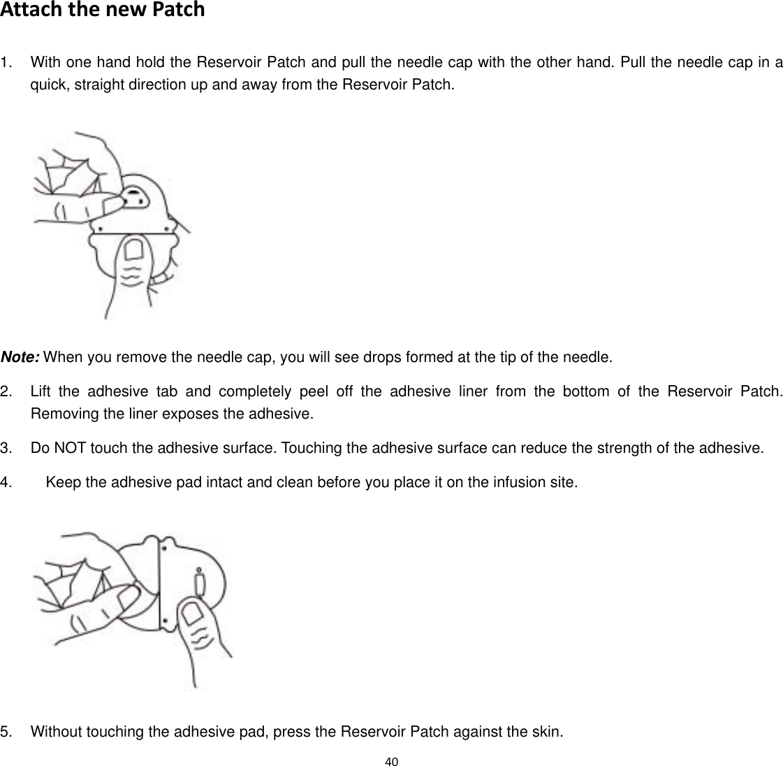  40  Attach the new Patch 1.  With one hand hold the Reservoir Patch and pull the needle cap with the other hand. Pull the needle cap in a quick, straight direction up and away from the Reservoir Patch.  Note: When you remove the needle cap, you will see drops formed at the tip of the needle. 2.  Lift the adhesive tab and completely peel off the adhesive liner from the bottom of the Reservoir Patch. Removing the liner exposes the adhesive. 3.  Do NOT touch the adhesive surface. Touching the adhesive surface can reduce the strength of the adhesive. 4.      Keep the adhesive pad intact and clean before you place it on the infusion site.  5.  Without touching the adhesive pad, press the Reservoir Patch against the skin. 