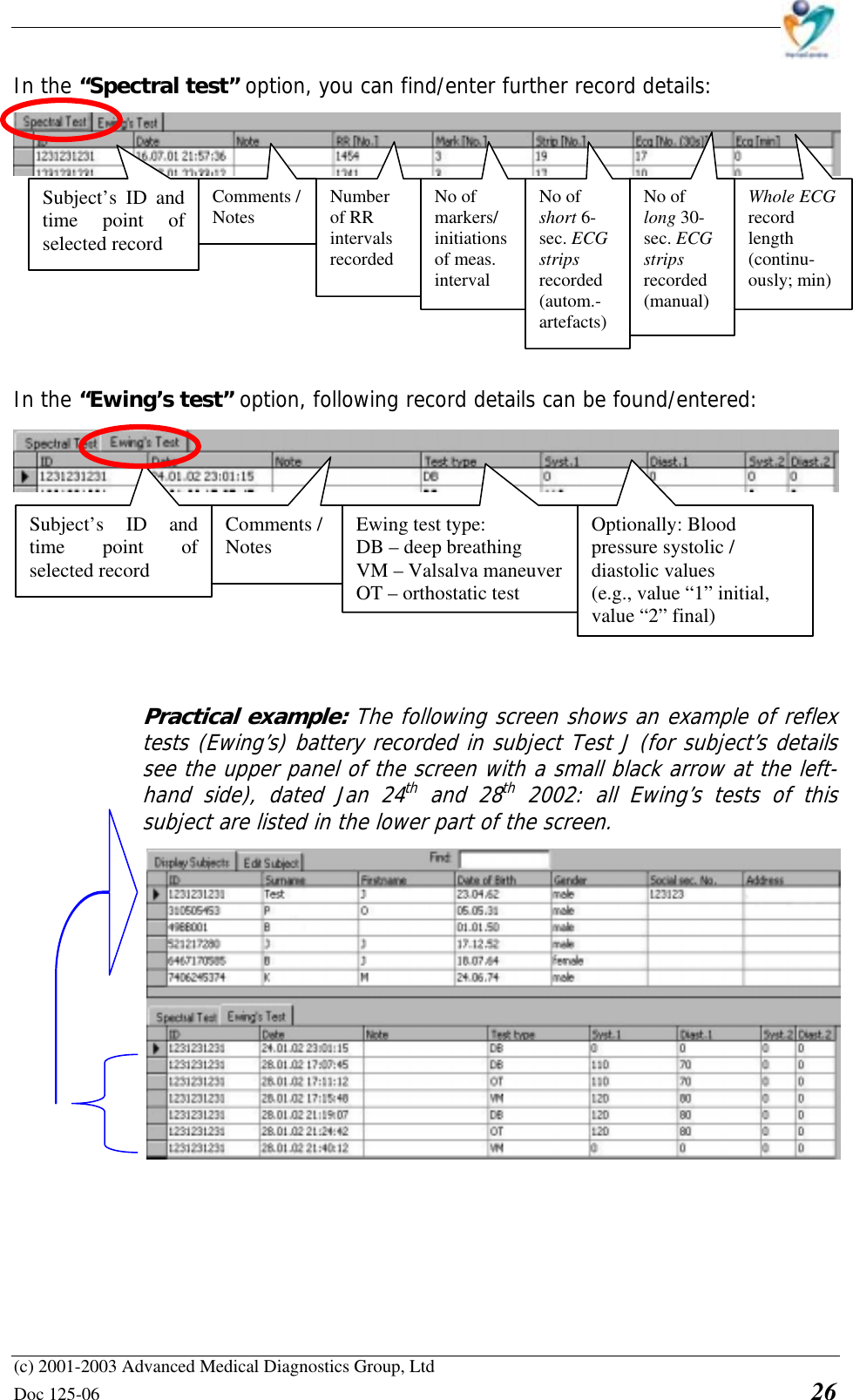    (c) 2001-2003 Advanced Medical Diagnostics Group, Ltd Doc 125-06    26 In the “Spectral test” option, you can find/enter further record details:          In the “Ewing’s test” option, following record details can be found/entered:          Practical example: The following screen shows an example of reflex tests (Ewing’s) battery recorded in subject Test J (for subject’s details see the upper panel of the screen with a small black arrow at the left-hand side), dated Jan 24th and 28th 2002: all Ewing’s tests of this subject are listed in the lower part of the screen.   Subject’s ID and time point of selected record Comments / Notes Subject’s ID and time point of selected record Comments / Notes  Number  of RR intervals recorded No of  markers/ initiations of meas. interval No of short 6-sec. ECG strips recorded (autom.- artefacts) No of long 30-sec. ECG strips recorded (manual) Whole ECG record length (continu-ously; min) Ewing test type: DB – deep breathing VM – Valsalva maneuverOT – orthostatic test Optionally: Blood pressure systolic / diastolic values (e.g., value “1” initial, value “2” final) 