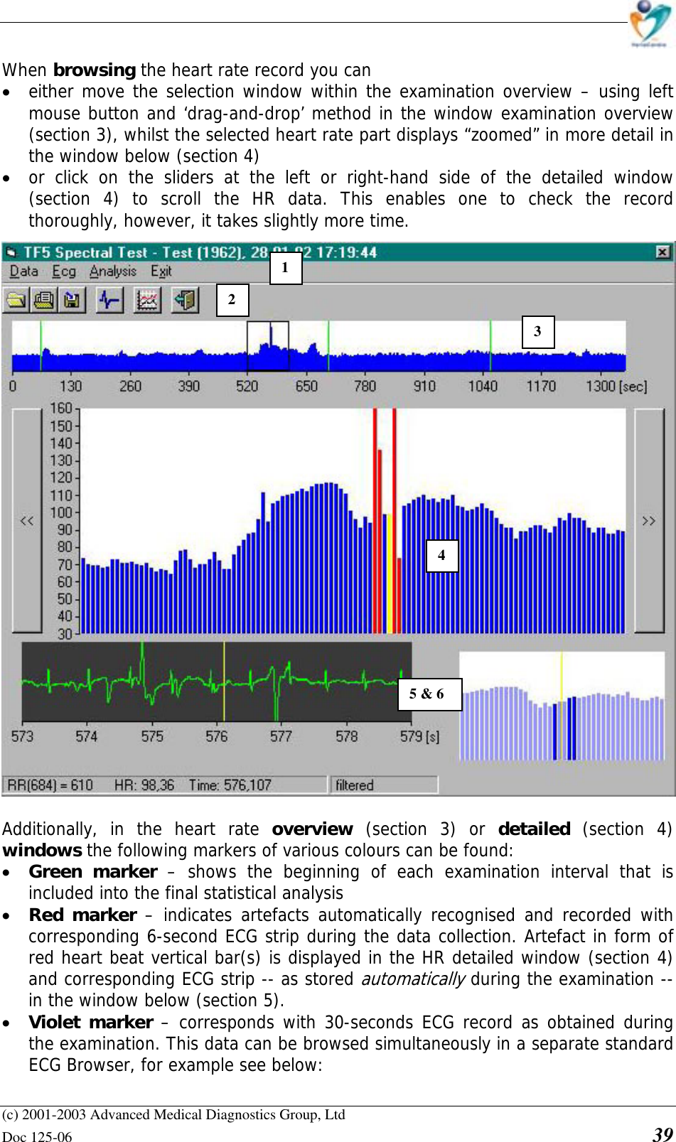    (c) 2001-2003 Advanced Medical Diagnostics Group, Ltd Doc 125-06    39 When browsing the heart rate record you can • either move the selection window within the examination overview – using left mouse button and ‘drag-and-drop’ method in the window examination overview (section 3), whilst the selected heart rate part displays “zoomed” in more detail in the window below (section 4) • or click on the sliders at the left or right-hand side of the detailed window (section 4) to scroll the HR data. This enables one to check the record thoroughly, however, it takes slightly more time.  Additionally, in the heart rate overview  (section 3) or detailed  (section 4) windows the following markers of various colours can be found: • Green marker – shows the beginning of each examination interval that is included into the final statistical analysis • Red marker – indicates artefacts automatically recognised and recorded with corresponding 6-second ECG strip during the data collection. Artefact in form of red heart beat vertical bar(s) is displayed in the HR detailed window (section 4) and corresponding ECG strip -- as stored automatically during the examination -- in the window below (section 5). • Violet marker – corresponds with 30-seconds ECG record as obtained during the examination. This data can be browsed simultaneously in a separate standard ECG Browser, for example see below: 12 3 45 &amp; 6 