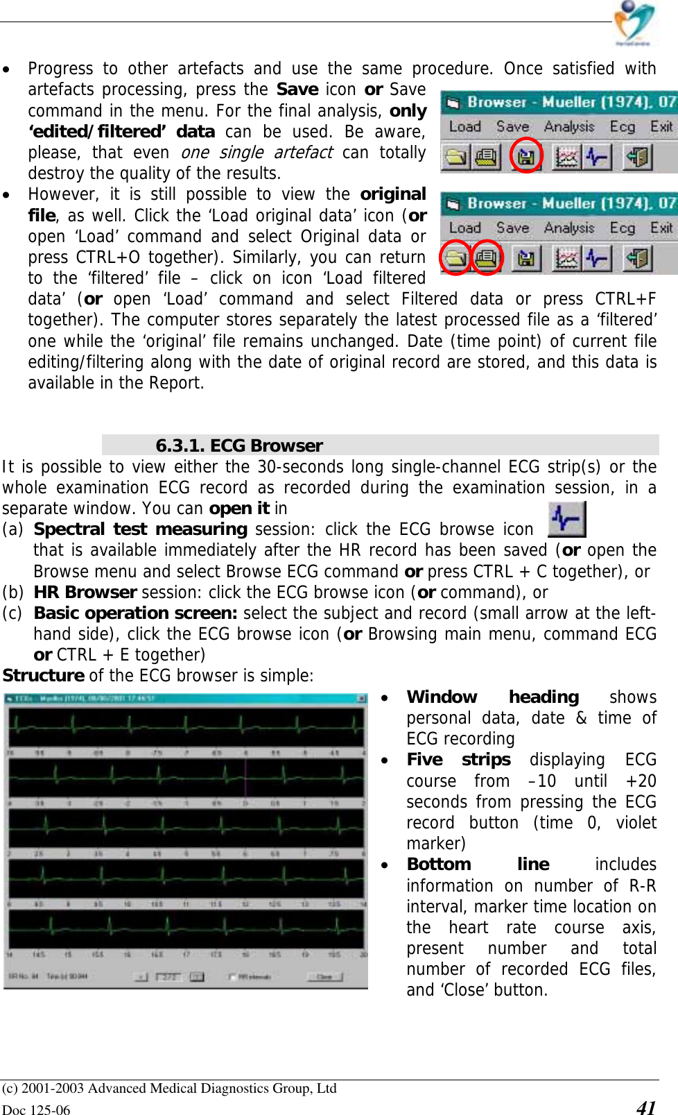    (c) 2001-2003 Advanced Medical Diagnostics Group, Ltd Doc 125-06    41 • Progress to other artefacts and use the same procedure. Once satisfied with artefacts processing, press the Save icon or Save command in the menu. For the final analysis, only ‘edited/filtered’ data can be used. Be aware, please, that even one single artefact can totally destroy the quality of the results. • However, it is still possible to view the original file, as well. Click the ‘Load original data’ icon (or open ‘Load’ command and select Original data or press CTRL+O together). Similarly, you can return to the ‘filtered’ file – click on icon ‘Load filtered data’ (or  open ‘Load’ command and select Filtered data or press CTRL+F together). The computer stores separately the latest processed file as a ‘filtered’ one while the ‘original’ file remains unchanged. Date (time point) of current file editing/filtering along with the date of original record are stored, and this data is available in the Report.   6.3.1. ECG Browser It is possible to view either the 30-seconds long single-channel ECG strip(s) or the whole examination ECG record as recorded during the examination session, in a separate window. You can open it in  (a) Spectral test measuring session: click the ECG browse icon that is available immediately after the HR record has been saved (or open the Browse menu and select Browse ECG command or press CTRL + C together), or (b) HR Browser session: click the ECG browse icon (or command), or  (c) Basic operation screen: select the subject and record (small arrow at the left-hand side), click the ECG browse icon (or Browsing main menu, command ECG or CTRL + E together) Structure of the ECG browser is simple:  • Window heading shows personal data, date &amp; time of ECG recording • Five strips displaying ECG course from –10 until +20 seconds from pressing the ECG record button (time 0, violet marker) • Bottom line includes information on number of R-R interval, marker time location on the heart rate course axis, present number and total number of recorded ECG files, and ‘Close’ button.  