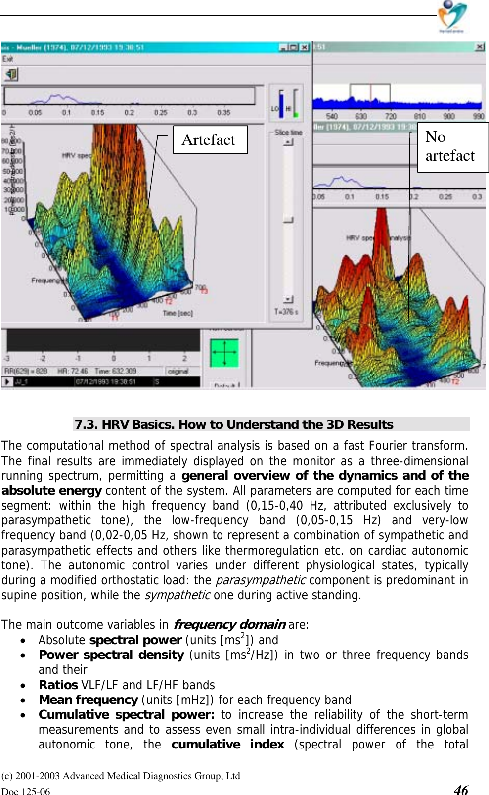    (c) 2001-2003 Advanced Medical Diagnostics Group, Ltd Doc 125-06    46   7.3. HRV Basics. How to Understand the 3D Results The computational method of spectral analysis is based on a fast Fourier transform. The final results are immediately displayed on the monitor as a three-dimensional running spectrum, permitting a general overview of the dynamics and of the absolute energy content of the system. All parameters are computed for each time segment: within the high frequency band (0,15-0,40 Hz, attributed exclusively to parasympathetic tone), the low-frequency band (0,05-0,15 Hz) and very-low frequency band (0,02-0,05 Hz, shown to represent a combination of sympathetic and parasympathetic effects and others like thermoregulation etc. on cardiac autonomic tone). The autonomic control varies under different physiological states, typically during a modified orthostatic load: the parasympathetic component is predominant in supine position, while the sympathetic one during active standing.  The main outcome variables in frequency domain are: • Absolute spectral power (units [ms2]) and  • Power spectral density (units [ms2/Hz]) in two or three frequency bands and their  • Ratios VLF/LF and LF/HF bands • Mean frequency (units [mHz]) for each frequency band • Cumulative spectral power: to increase the reliability of the short-term measurements and to assess even small intra-individual differences in global autonomic tone, the cumulative index (spectral power of the total Artefact No artefact 