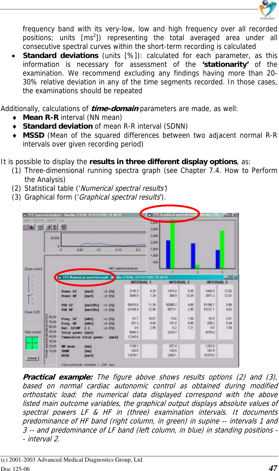    (c) 2001-2003 Advanced Medical Diagnostics Group, Ltd Doc 125-06    47 frequency band with its very-low, low and high frequency over all recorded positions; units [ms2]) representing the total averaged area under all consecutive spectral curves within the short-term recording is calculated  • Standard deviations (units [%]): calculated for each parameter, as this information is necessary for assessment of the ‘stationarity’  of the examination. We recommend excluding any findings having more than 20-30% relative deviation in any of the time segments recorded. In those cases, the examinations should be repeated  Additionally, calculations of time-domain parameters are made, as well: ♦ Mean R-R interval (NN mean) ♦ Standard deviation of mean R-R interval (SDNN) ♦ MSSD (Mean of the squared differences between two adjacent normal R-R intervals over given recording period)  It is possible to display the results in three different display options, as:  (1) Three-dimensional running spectra graph (see Chapter 7.4. How to Perform the Analysis) (2) Statistical table (‘Numerical spectral results’)  (3) Graphical form (‘Graphical spectral results’).   Practical example: The figure above shows results options (2) and (3), based on normal cardiac autonomic control as obtained during modified orthostatic load: the numerical data displayed correspond with the above listed main outcome variables, the graphical output displays absolute values of spectral powers LF &amp; HF in (three) examination intervals. It documents predominance of HF band (right column, in green) in supine -- intervals 1 and 3 -- and predominance of LF band (left column, in blue) in standing positions -- interval 2. 