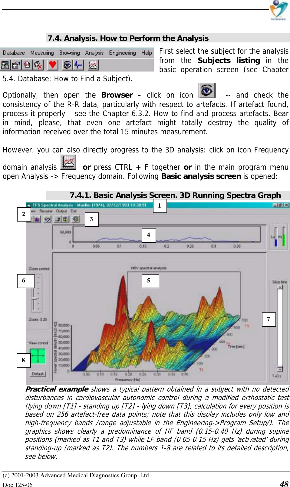    (c) 2001-2003 Advanced Medical Diagnostics Group, Ltd Doc 125-06    48  7.4. Analysis. How to Perform the Analysis First select the subject for the analysis from the Subjects listing in the basic operation screen (see Chapter 5.4. Database: How to Find a Subject).  Optionally, then open the Browser  – click on icon    -- and check the consistency of the R-R data, particularly with respect to artefacts. If artefact found, process it properly – see the Chapter 6.3.2. How to find and process artefacts. Bear in mind, please, that even one artefact might totally destroy the quality of information received over the total 15 minutes measurement.  However, you can also directly progress to the 3D analysis: click on icon Frequency domain analysis    or press CTRL + F together or in the main program menu open Analysis -&gt; Frequency domain. Following Basic analysis screen is opened:   7.4.1. Basic Analysis Screen. 3D Running Spectra Graph Practical example shows a typical pattern obtained in a subject with no detected disturbances in cardiovascular autonomic control during a modified orthostatic test (lying down [T1] - standing up [T2] - lying down [T3], calculation for every position is based on 256 artefact-free data points; note that this display includes only low and high-frequency bands /range adjustable in the Engineering-&gt;Program Setup/). The graphics shows clearly a predominance of HF band (0.15-0.40 Hz) during supine positions (marked as T1 and T3) while LF band (0.05-0.15 Hz) gets ‘activated’ during standing-up (marked as T2). The numbers 1-8 are related to its detailed description, see below.  12  3 45 76 8 